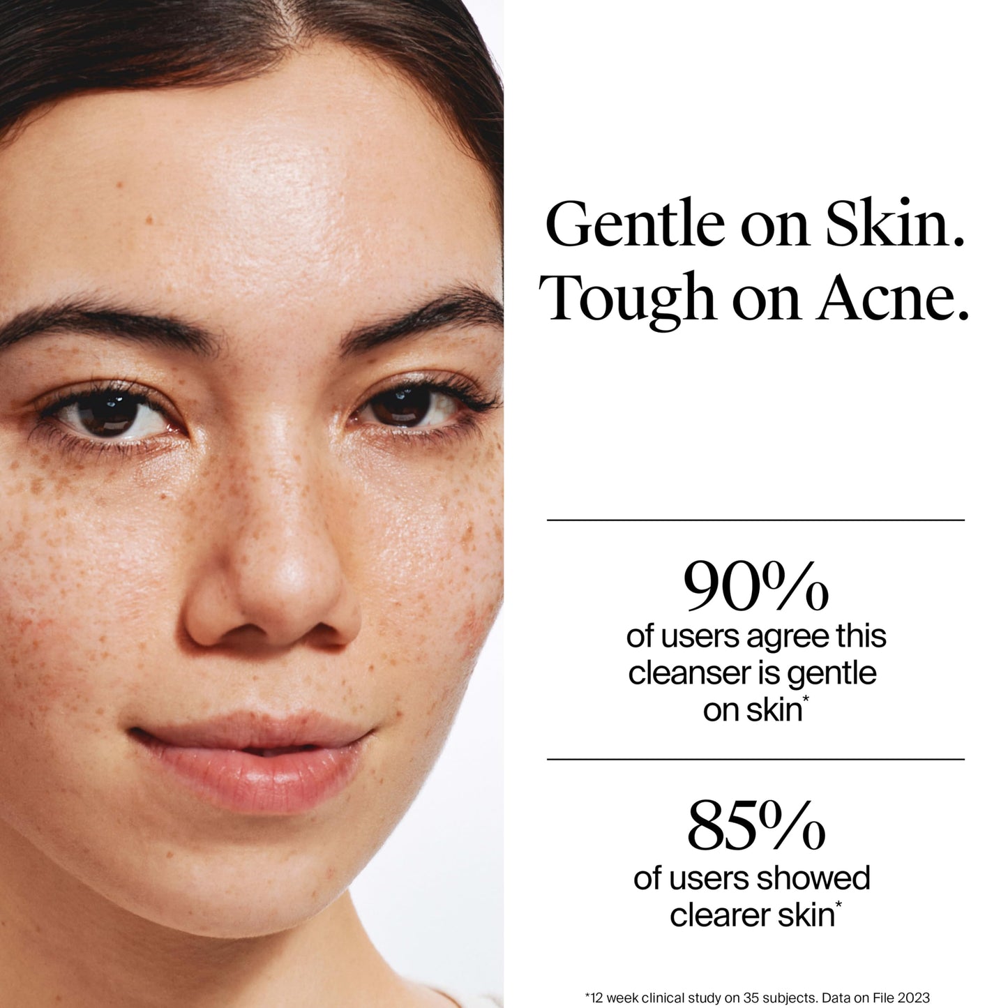 Neutrogena Oil-Free Acne Face Wash, Fragrance Free, Sensitive Skin Facial Cleanser with 2% Salicylic Acid Acne Treatment for Face, 9.1 Fl Oz Beauty and Personal Care Neutrogena