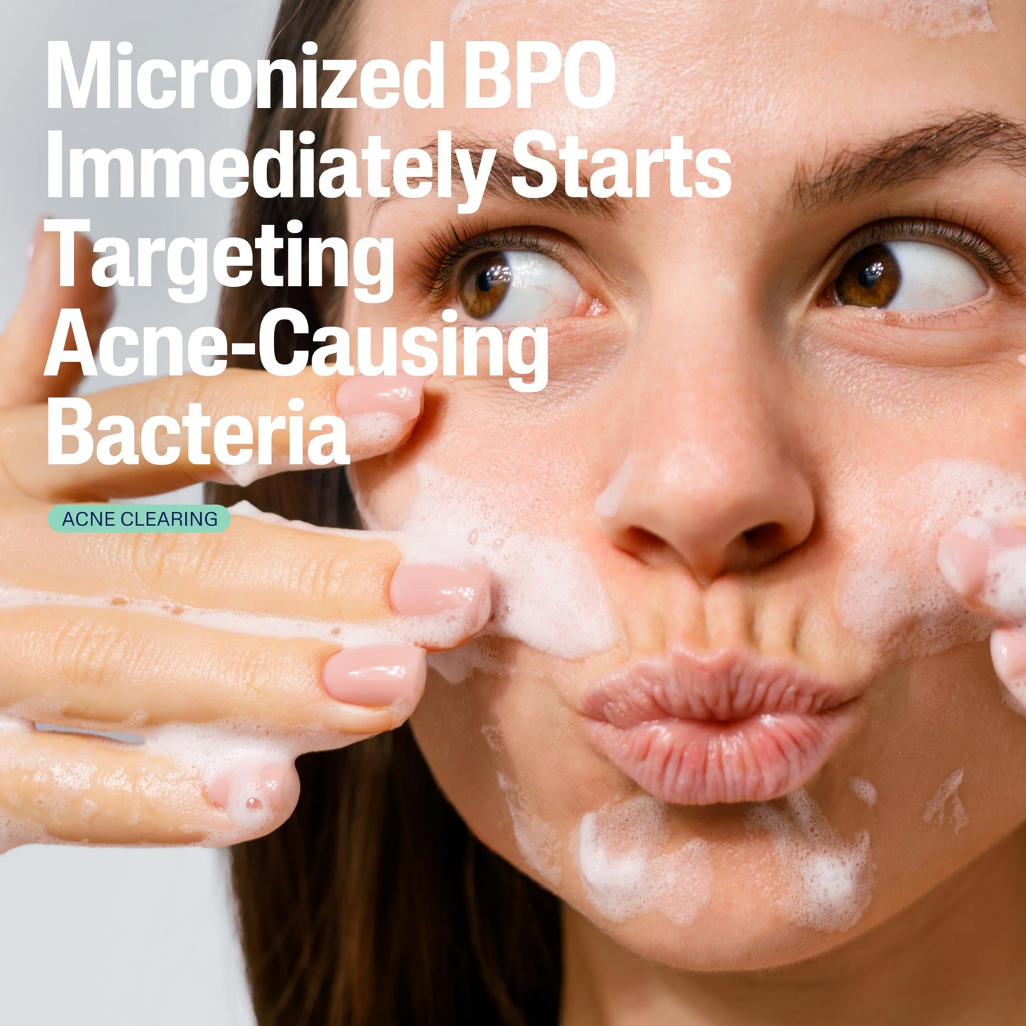 Cetaphil Gentle Clear Complexion-Clearing BPO Acne Cleanser with 2.6% Benzoyl Peroxide, Creamy and Soothing for Sensitive Skin, Suitable for All Skin