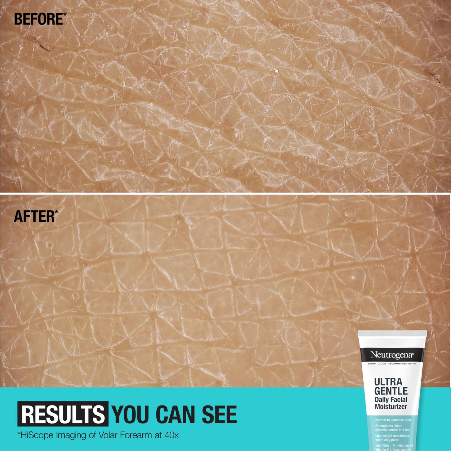 Neutrogena Fragrance Free Daily Facial Moisturizer, Face & Neck Moisturizer for Sensitive Skin with Vitamin B3, Pro-Vitamin B5 & Vitamin E Supports