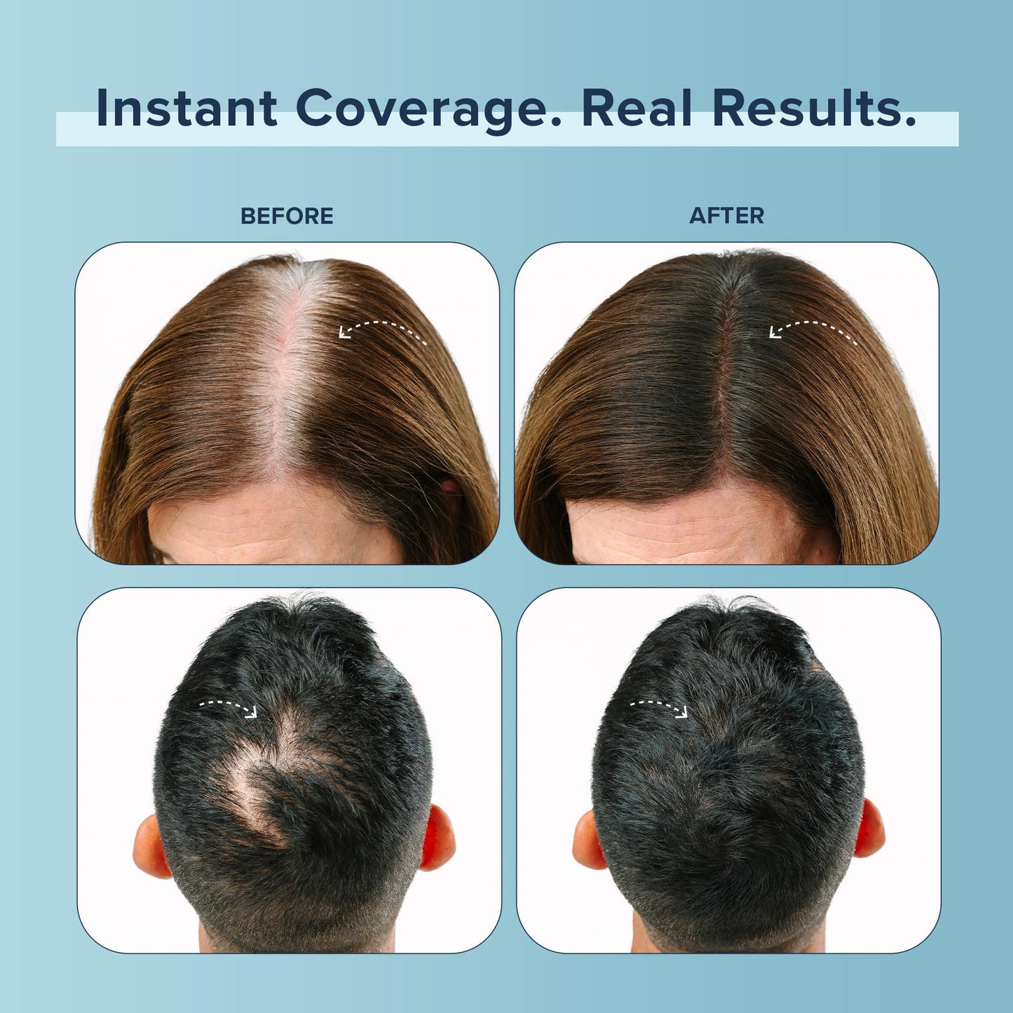 TRUHAIR Color Fibers Root Coverage and Density Booster Refill | Quick-Apply Touch Up Hair Color | Natural Matching, Gray Hair Cover Up - 11 Colors