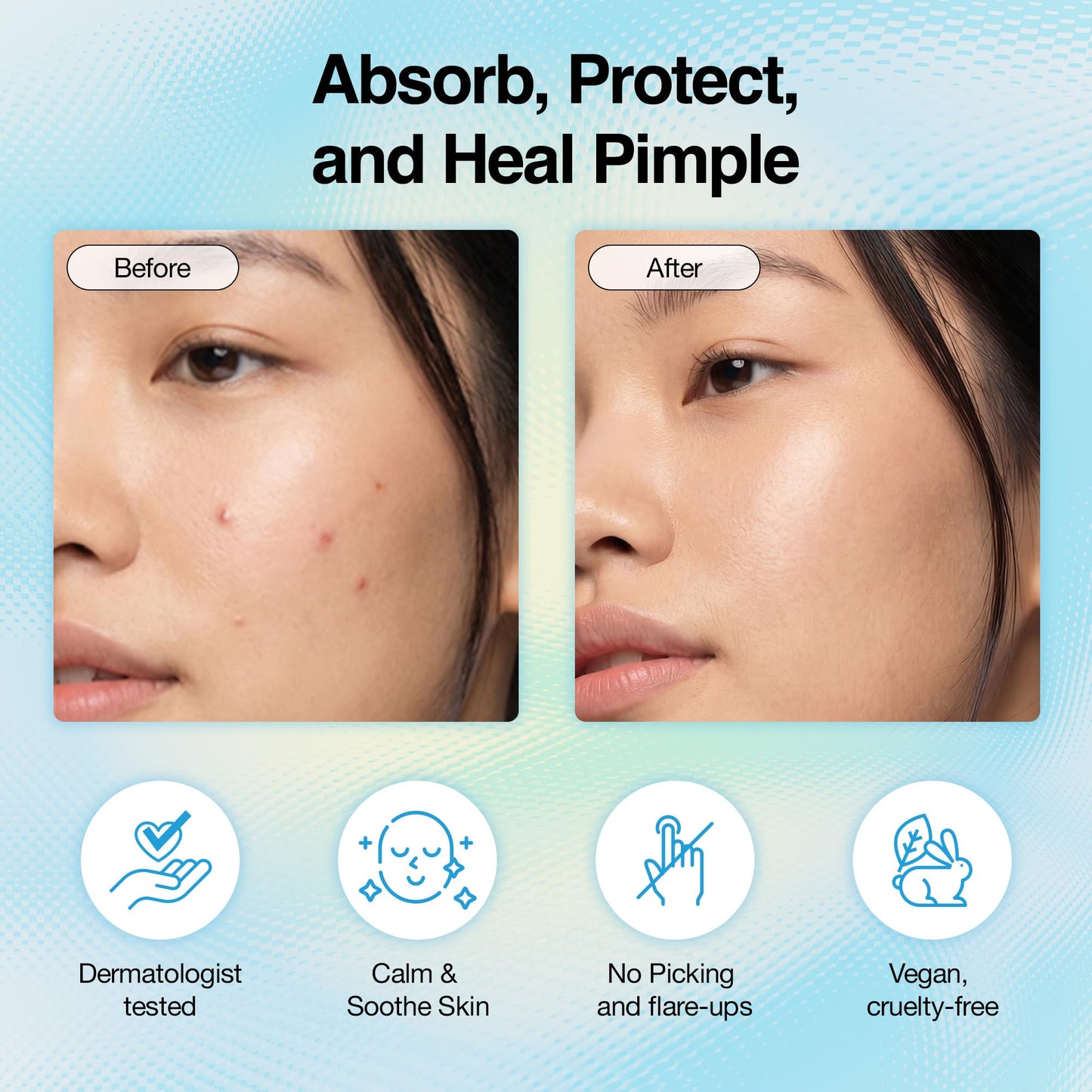 FreeGo WOO JU (??) Hydrocolloid Pimple Patch 120 Counts | Cute Colorful Star Shape | Salicylic Acid, Niacinamide, CICA, Tea Tree | Made in Korea