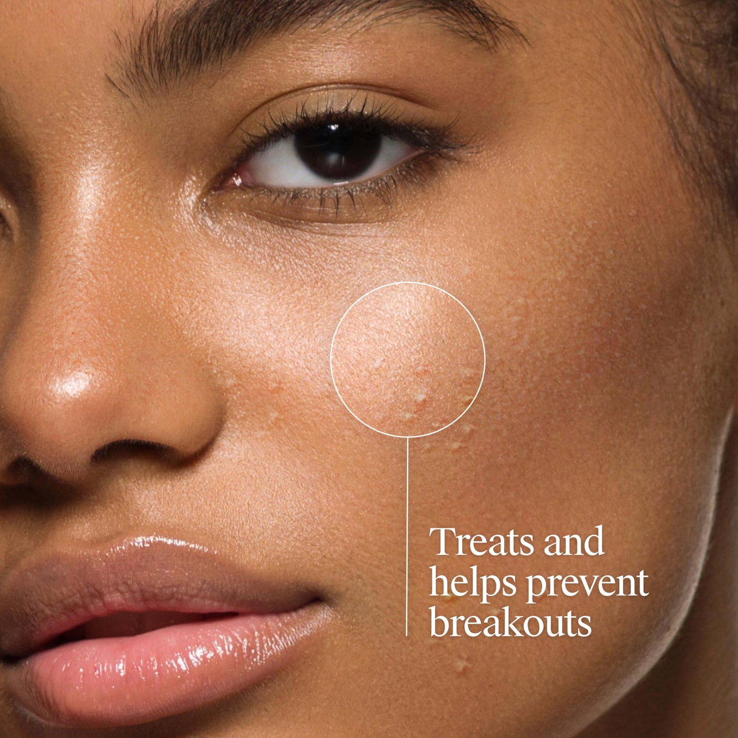 Neutrogena Oil-Free Acne Face Wash, Fragrance Free, Sensitive Skin Facial Cleanser with 2% Salicylic Acid Acne Treatment for Face, 9.1 Fl Oz Beauty and Personal Care Neutrogena