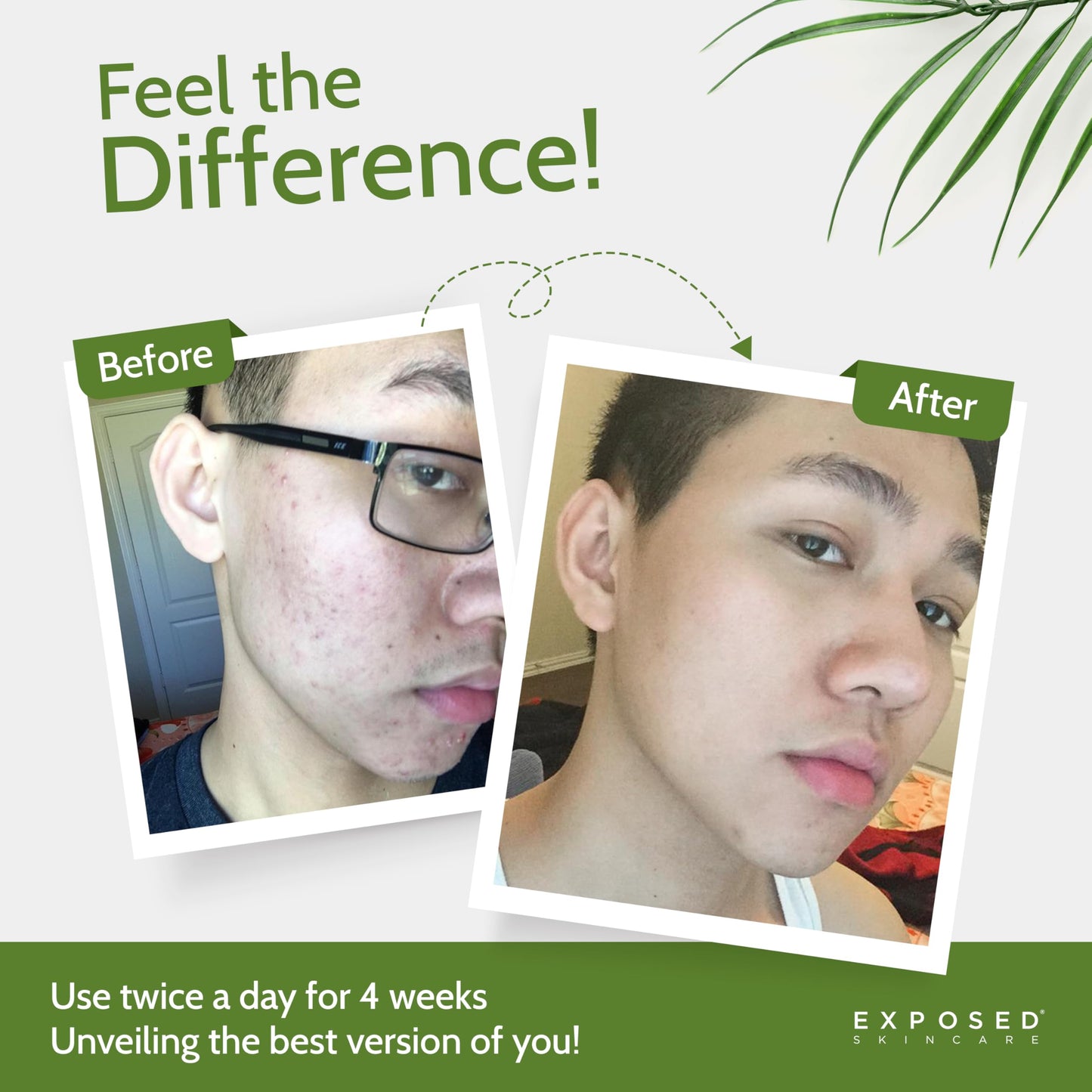 Exposed Skin Care, Clear Pore Serum with 1% Salicylic Acid for Sensitive and Oily Skin - Gently Clears Blackheads, Minimizes Pores and Reduces Excess