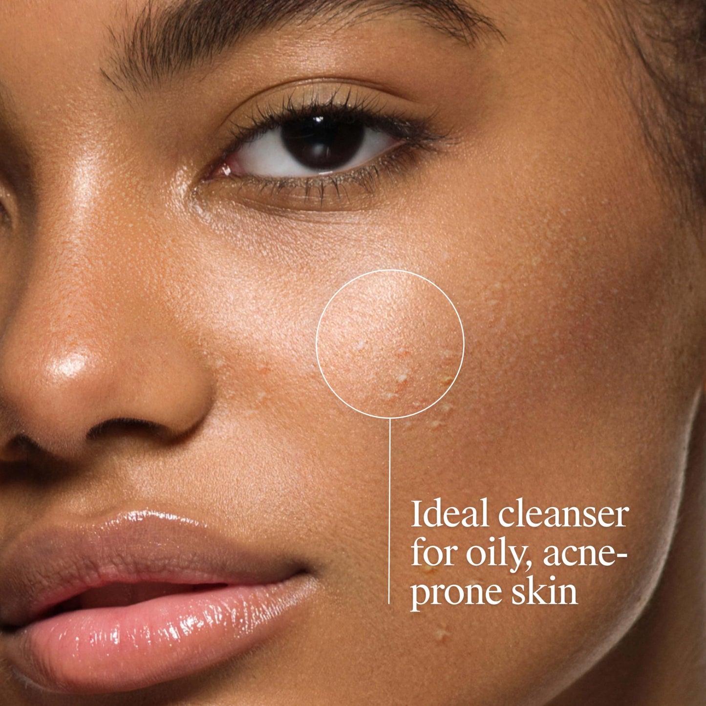 Neutrogena Oil-Free Acne Face Wash - Facial Cleanser with Salicylic Acid, Daily Cleanser for Oily & Acne-Prone Skin, Clears & Helps Prevent Breakouts