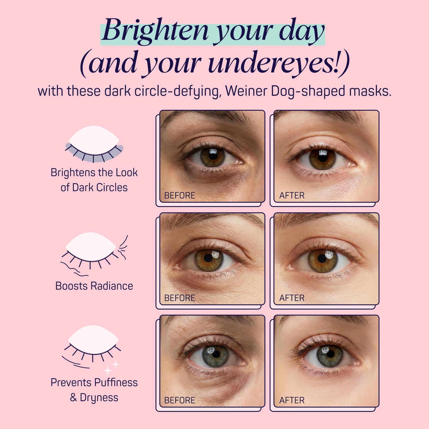SpaLife So Fetch Hydrogel Under Eye Patches for Dark Circles | Dachshund Under Eye Patches for Puffy Eyes | Weiner Dog Undereye Bags and Puffiness Beauty and Personal Care SpaLife
