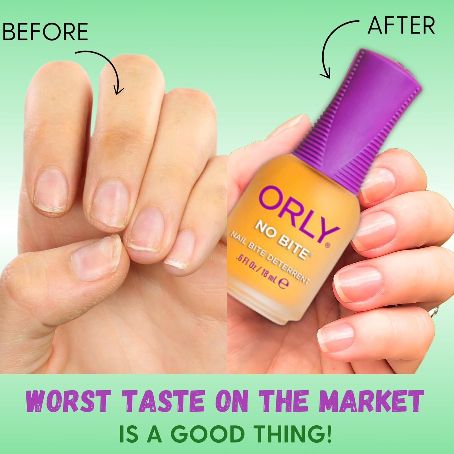ORLY Nail Treatment No Bite | Nail Biting Deterrent & Bitter-Tasting Formula To Help Stop Adults And Children From Nail Biting | Vegan, Non-Toxic