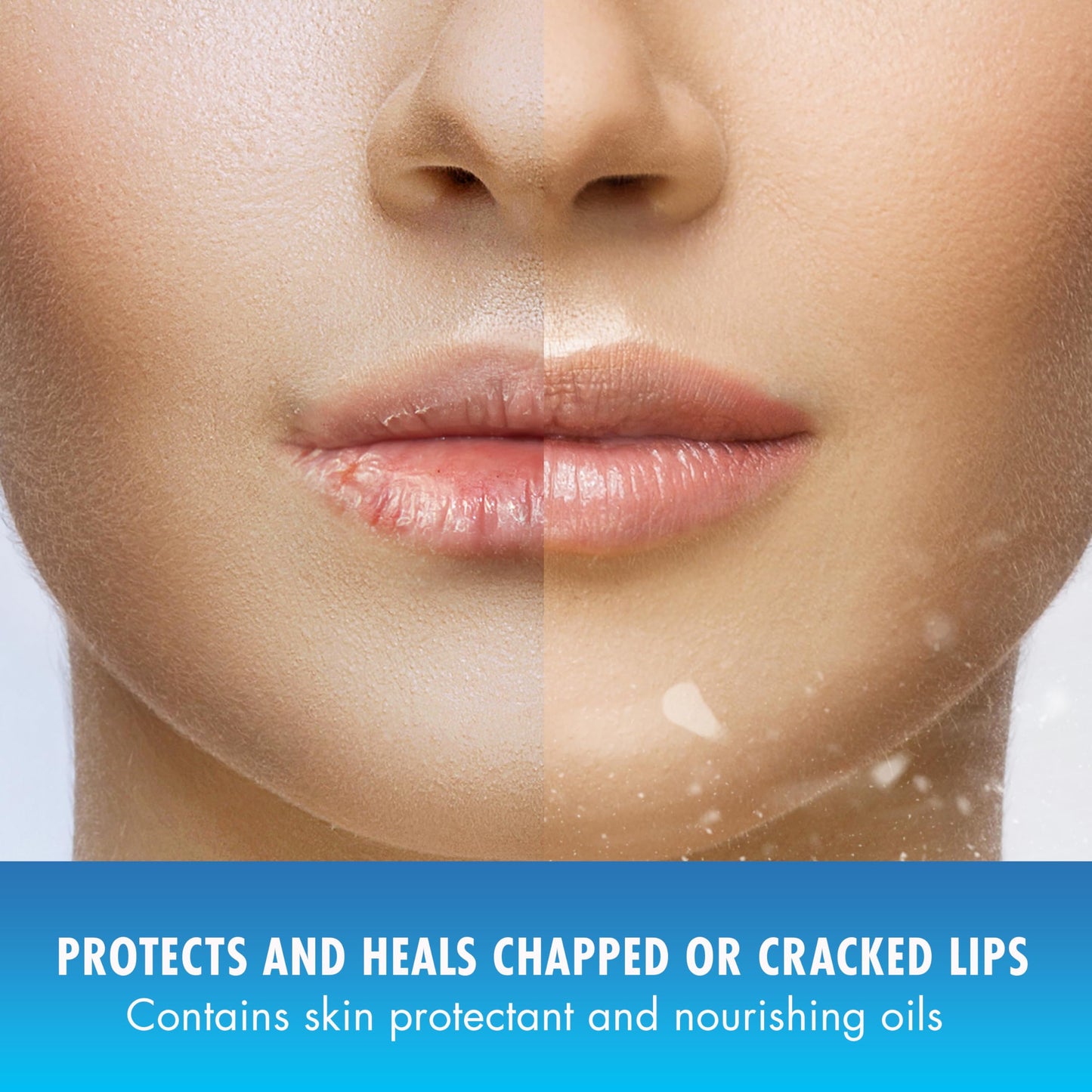 Natural Ice Original Medicated Lip Balm, Hydrating Lip Care for Dry, Chapped Lips, Moisturizing Formula with SPF 15 Helps Prevent Sunburn, Protection