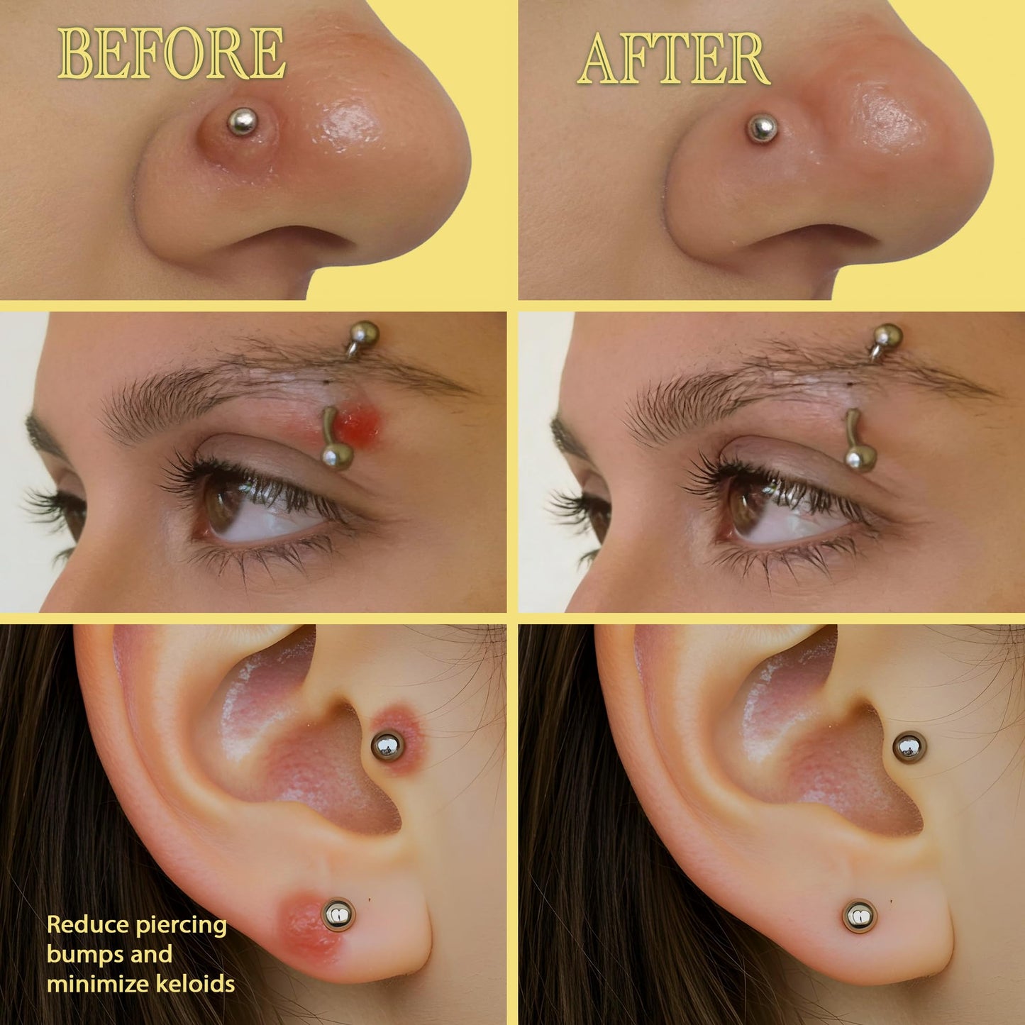 BodyJ4You Keloid Bump Removal Oil - Piercing Aftercare Shrinking Drops - Nose Ear Septum Belly Cartilage Scar Treatment Piercing Bump Solution - Tea Beauty and Personal Care BodyJ4You