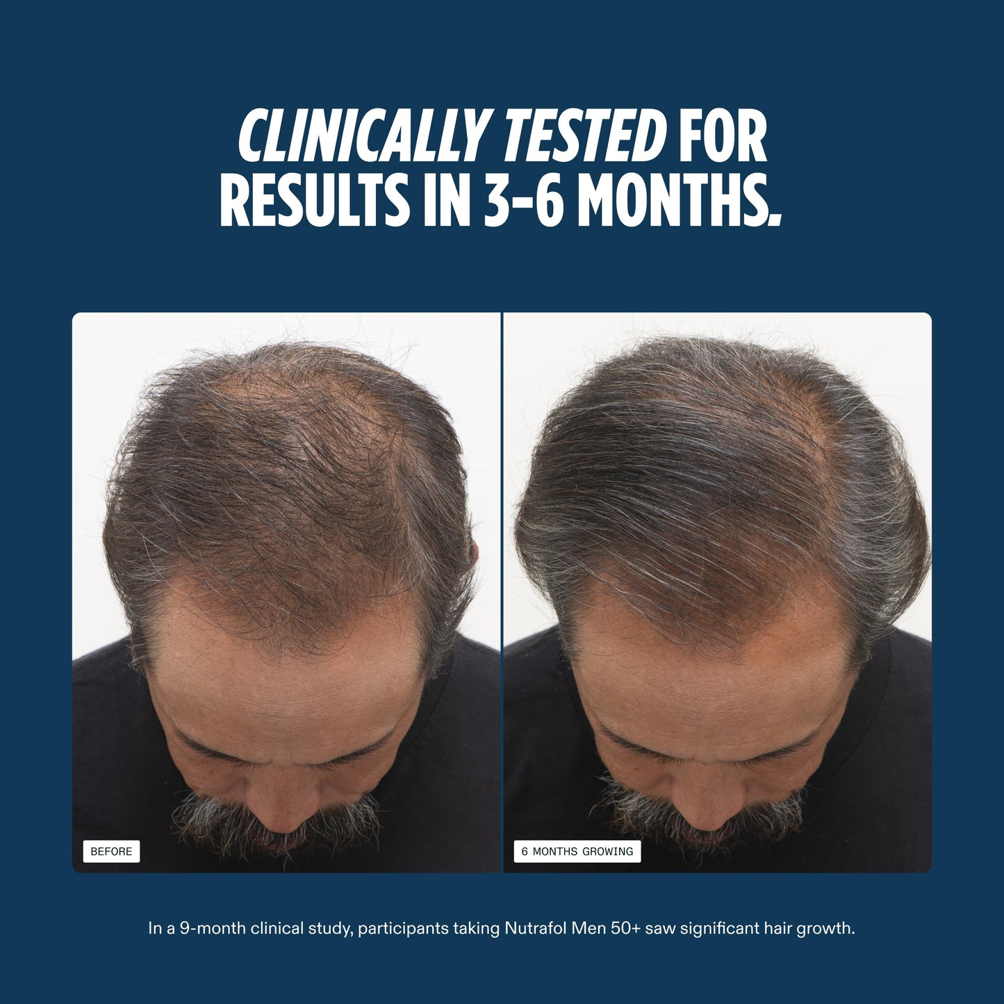 Nutrafol Men 50+ Hair Growth Supplements, Clinically Tested for Visibly Thicker Hair and Scalp Coverage, #1 Dermatologist-Recommended Hair Growth Beauty and Personal Care Nutrafol