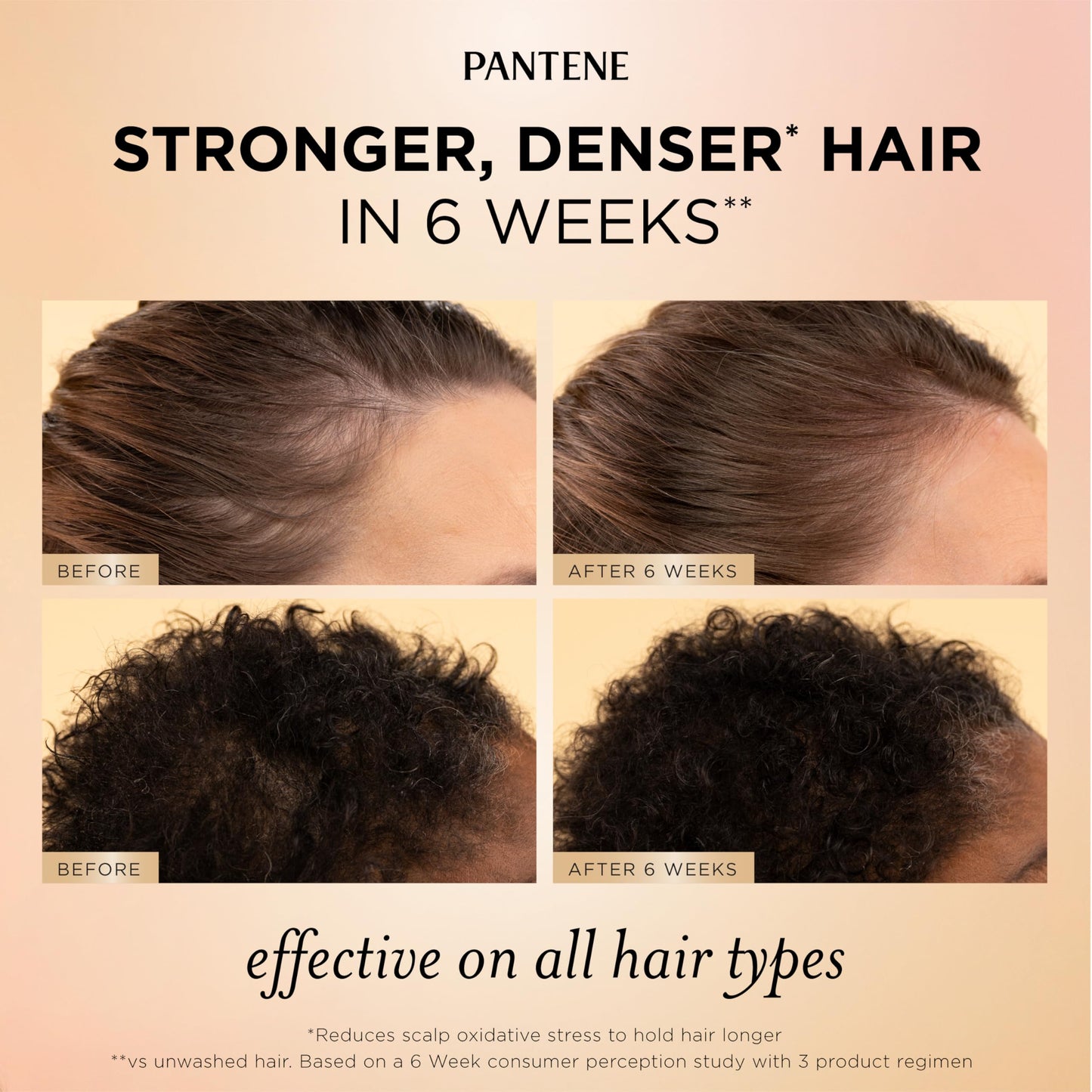 Pantene Abundant & Strong 3-Piece Regimen with B5 Complex + Niacinamide, Shampoo (13.5 oz), Conditioner (8 oz), Serum (2 oz) for Hair Loss, Thinning