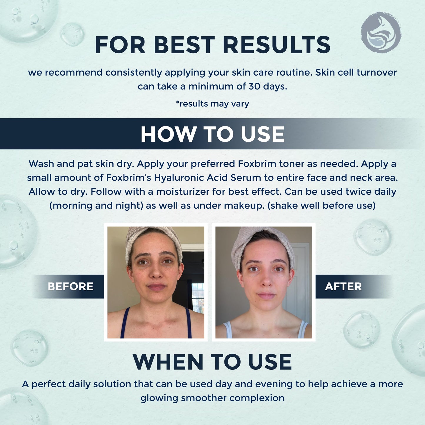 Hyaluronic Acid Face Serum - Hydrating Anti Wrinkle Anti Aging Facial Serum - With Vitamin C and E, Green Tea, Jojoba Oil - Natural and Organic - 1