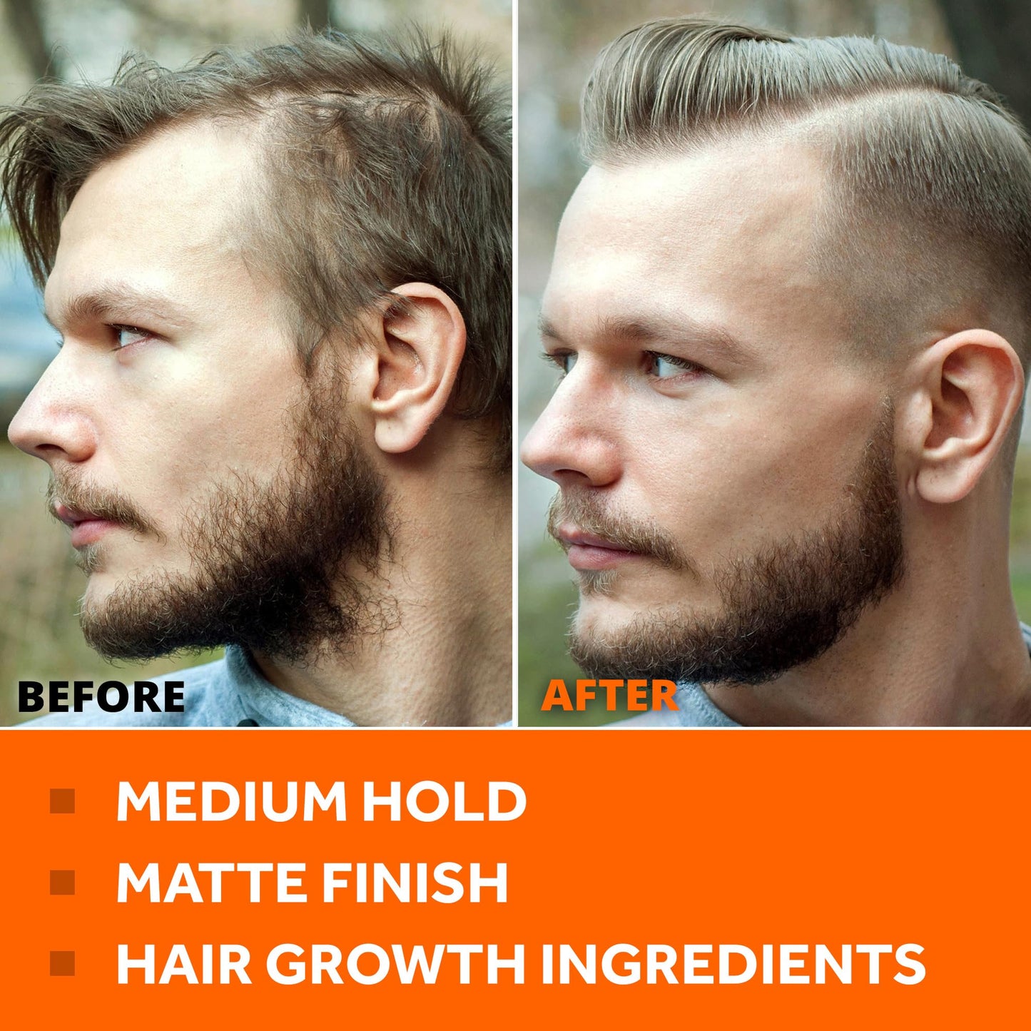 FOLLICLE BOOSTER Hair Growth Pomade - 1 Pack, Infused with Thinning Combating Ingredients, Water-based Cream Formulation, Ethically Sourced, Medium