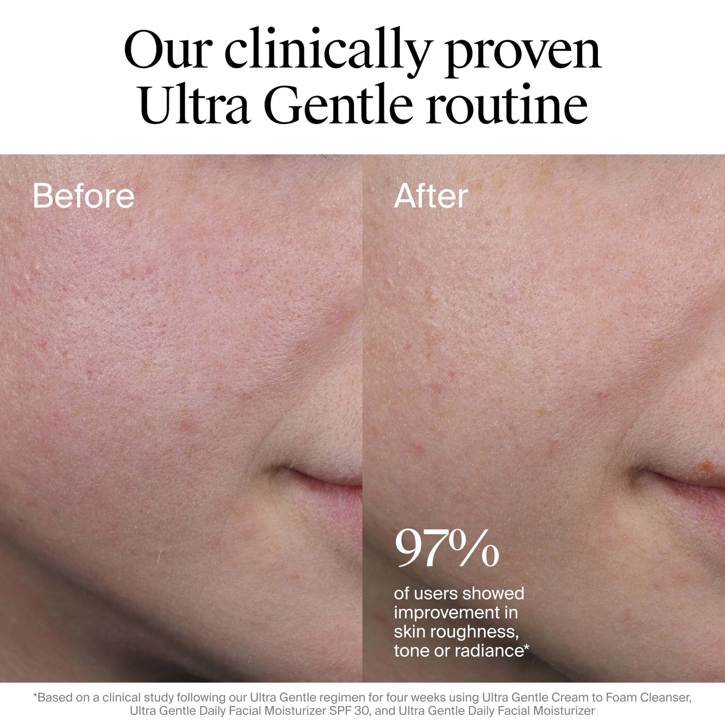 Neutrogena Ultra Gentle Daily Facial Moisturizer with SPF 30 Sunscreen with CICA, Lightweight Face Lotion with Broad Spectrum SPF 30 for Normal Beauty and Personal Care Neutrogena