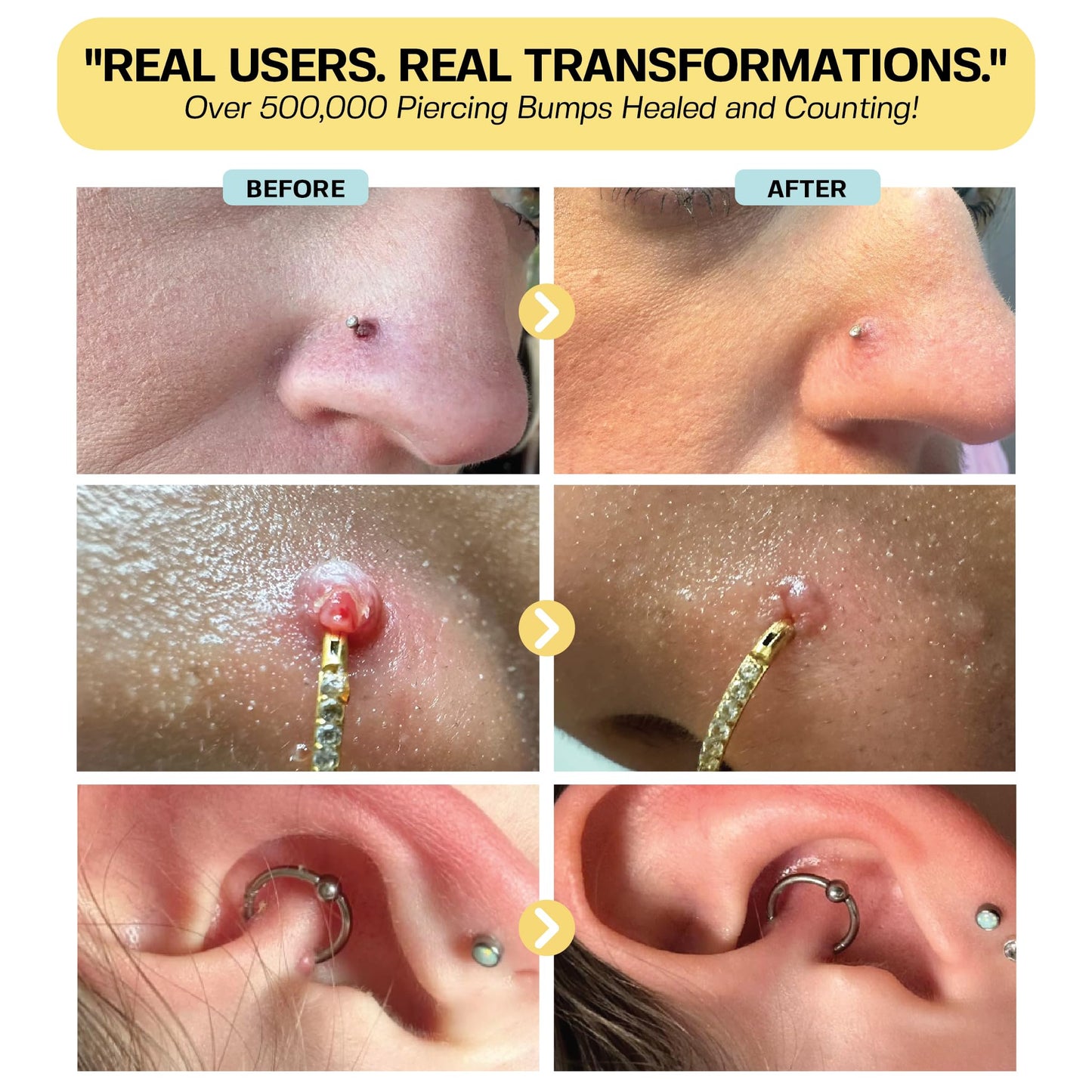 BASE LABORATORIES Piercing Bump Solution & Keloid Bump Removal | Soothing Piercing Aftercare for Piercing Bumps & Keloid Scar Removal | Ear & Nose Beauty and Personal Care BASE LABORATORIES