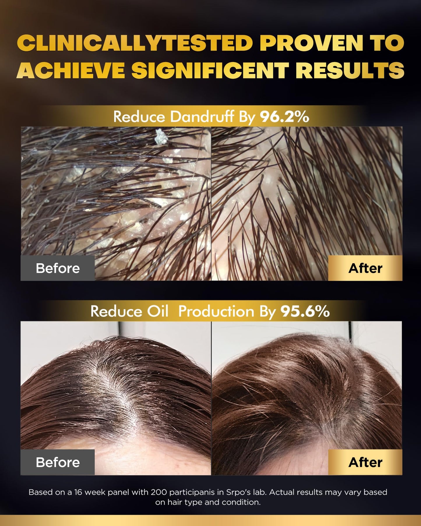 COOLKESI Tripeptide-Infused Biotin Hair Growth Shampoo and Conditioner Set, Onion Anti-Loss Volumizing Moisturizing Treatment for Soft Shine Hair