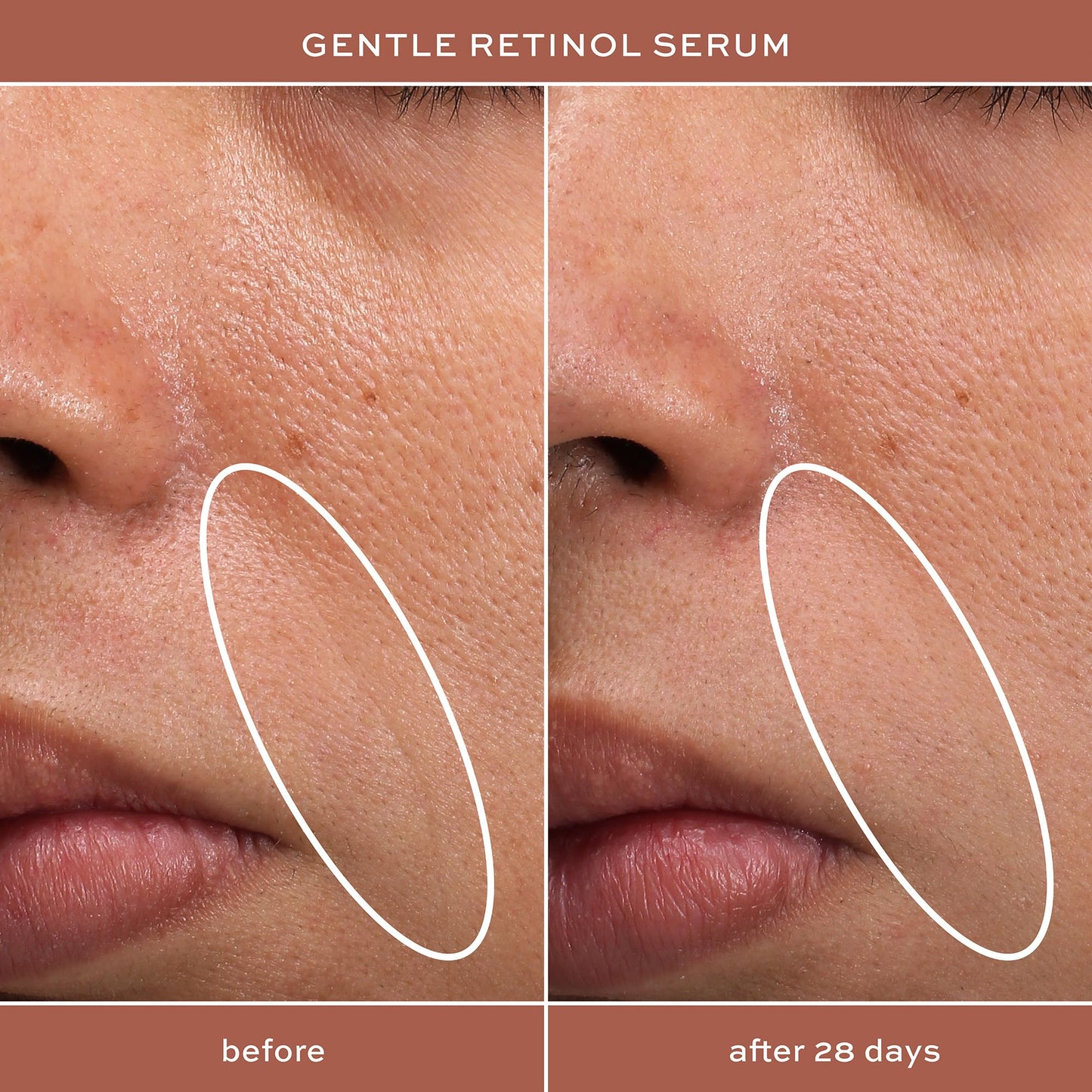ITK Skincare Gentle Hydrating Nightly Retinol Facial Serum for All Skin Types, 1 oz