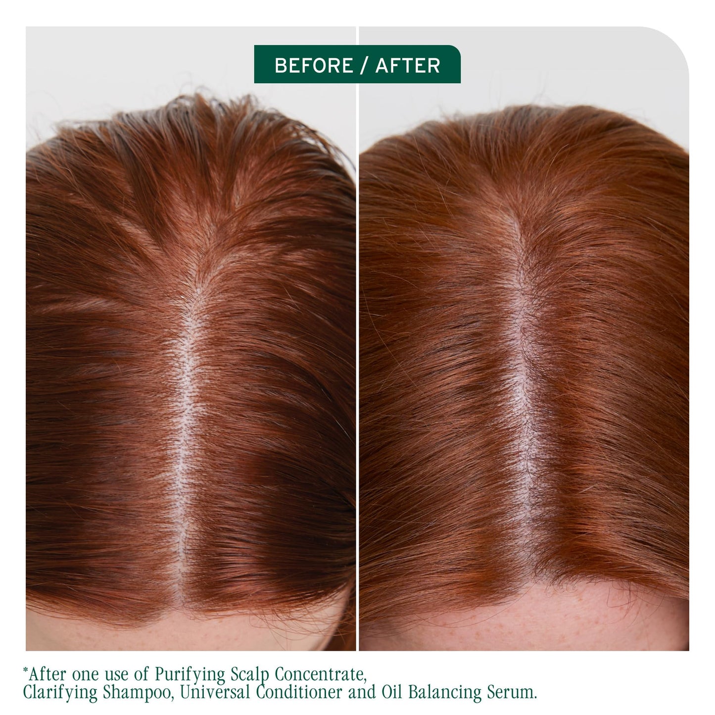 Biolage Scalp Sync Clarifying Shampoo - Residue & Buildup Remover, For Oily Scalp, Fermented Tea & Glycolic Acid, Vegan & Paraben-Free, 13.5 Fl Oz