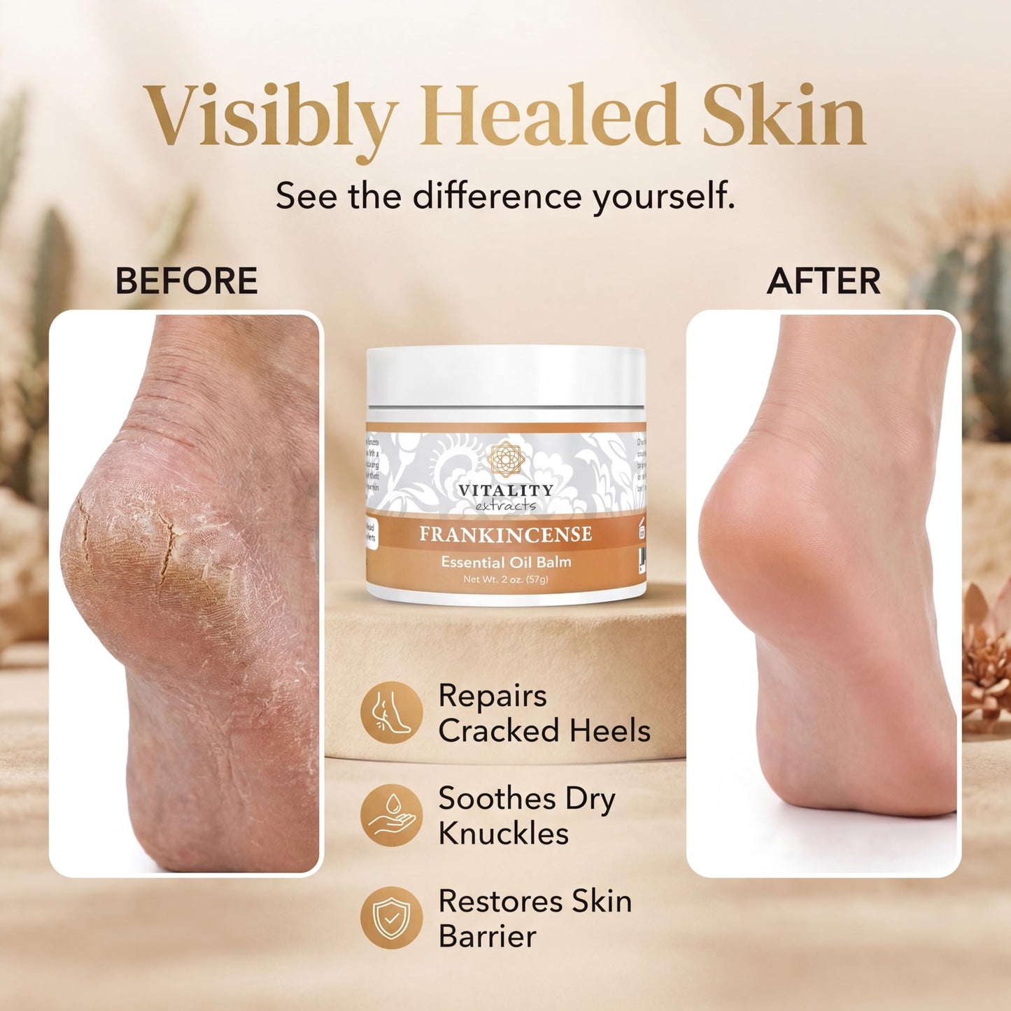 Vitality Extracts Frankincense Essential Oil Balm (2oz) - Boswellia Serrata, Beeswax & Vitamin E, Deep Moisturizing Skin Balm for Dry, Cracked Skin Beauty and Personal Care Vitality