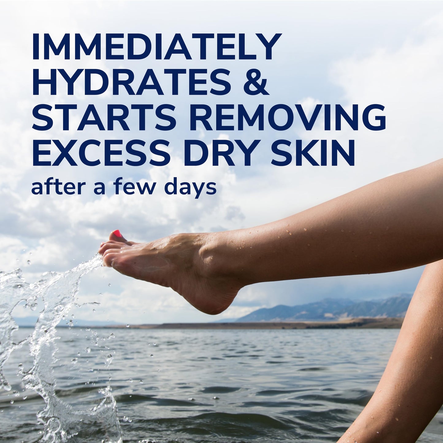 Dr. Scholl's Ultra Exfoliating Foot Lotion 3.5oz – Urea Moisturizer for Dry, Cracked Feet, Heals, Soothes & Smooths for Healthy Skin