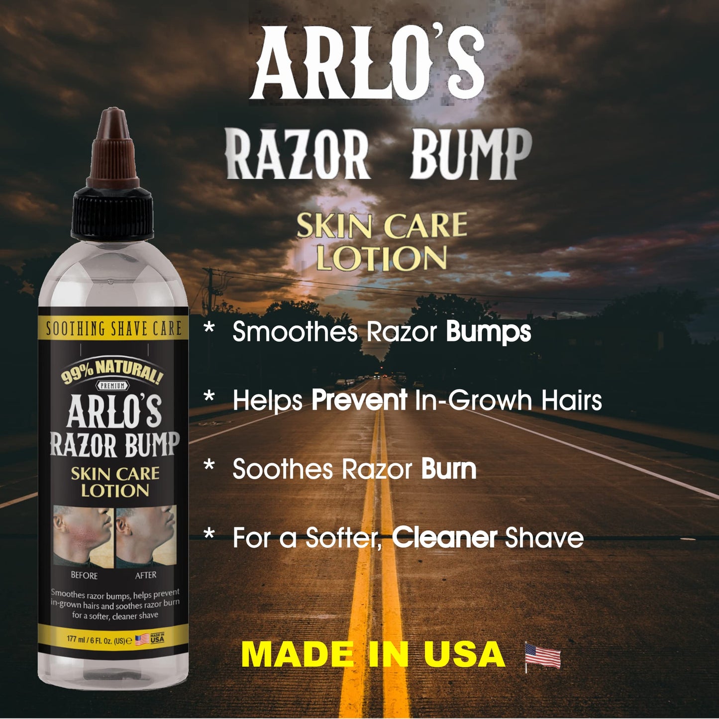 Arlo's Razor Bump Skin Care Lotion 6 oz.