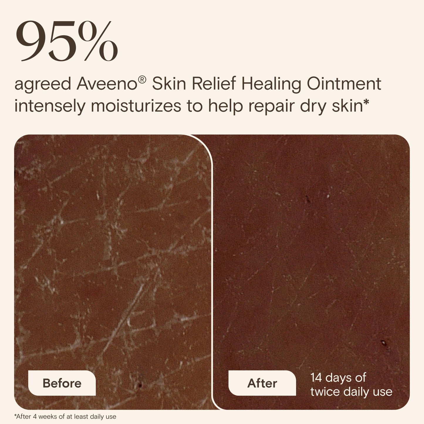 Aveeno Skin Relief Healing Ointment, Repair & Protect Extra Dry, Cracked Skin, Glycerin Protectant with Triple Oat & Shea Butter, Fragrance-Free Beauty and Personal Care Aveeno