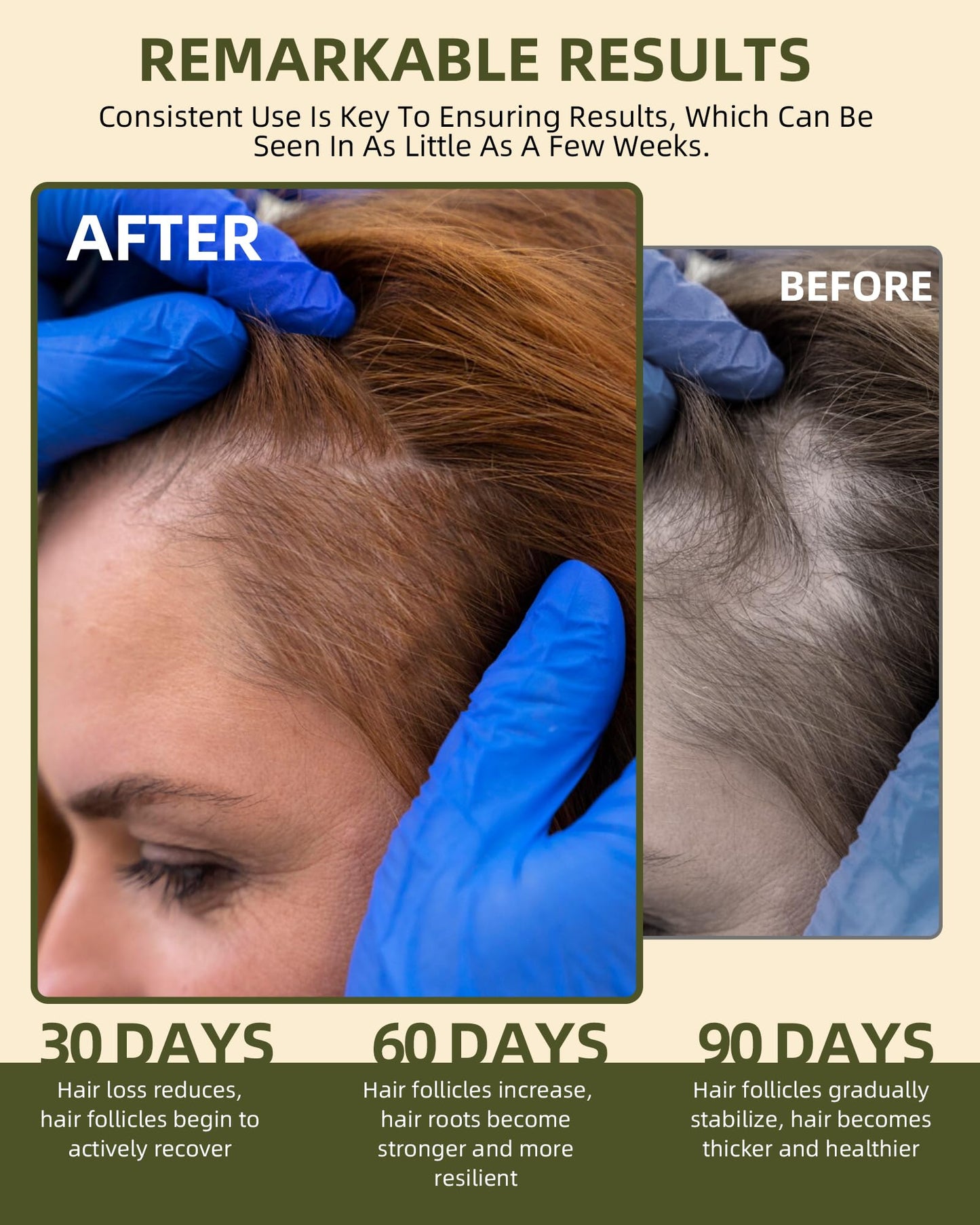 Ktintar 100% Natural Raw Batana Oil for Hair Growth, Dr Sebi Hair Growth Oil From Honduras, Thicker & Stronger Hair, Prevents Hair Loss, Eliminates