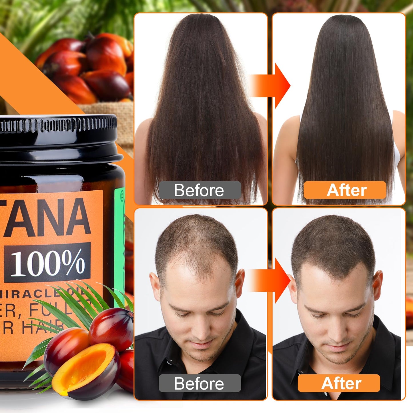 WEEMOTD Unrefined Batana Oil for Hair Growth, Dr. Sebi Raw Batana Oil from Honduras, Hair Mask Hair Growth oil with Organic and Natural Ingredients