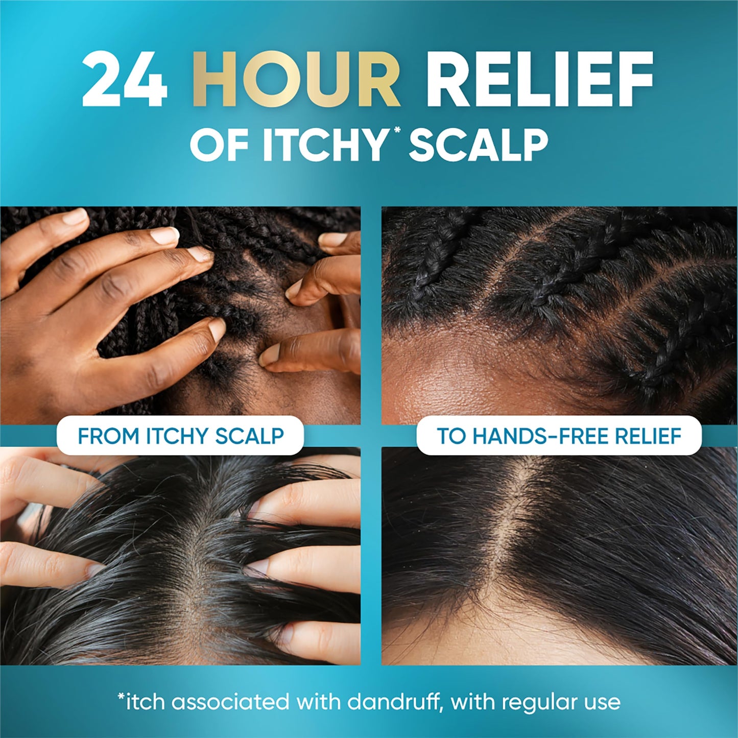 Head & Shoulders Royal Oils Scalp Elixir Treatment, Formulated with Cooling Menthol and Peppermint Oil for Instant Scalp Soothe and Hydration, 4.2 fl Beauty and Personal Care Head & Shoulders