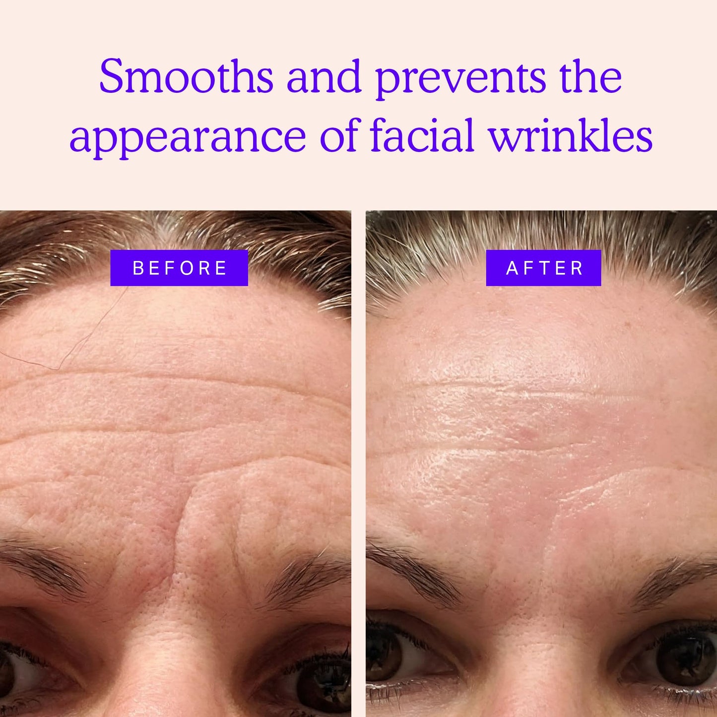 BLUMBODY Face, Forehead Wrinkle Patches - Mini Anti-Wrinkle Facial Patches for Eyes, Mouth, Forehead - Triangle Non-Silicone Face Tape for Elevens