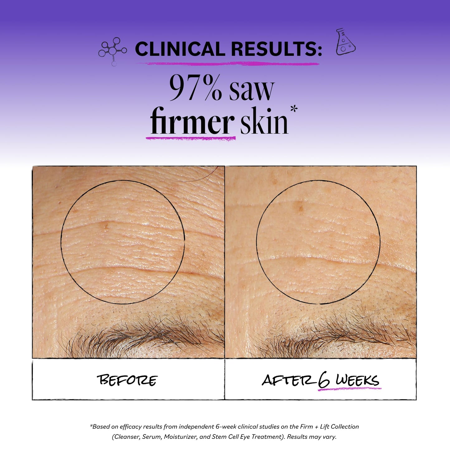 DERMA E Ultra Lift DMAE Concentrated Serum - All Natural Skin Firming Serum - Hydrating Serum with Copper Peptides and Resveratrol - Concentrated