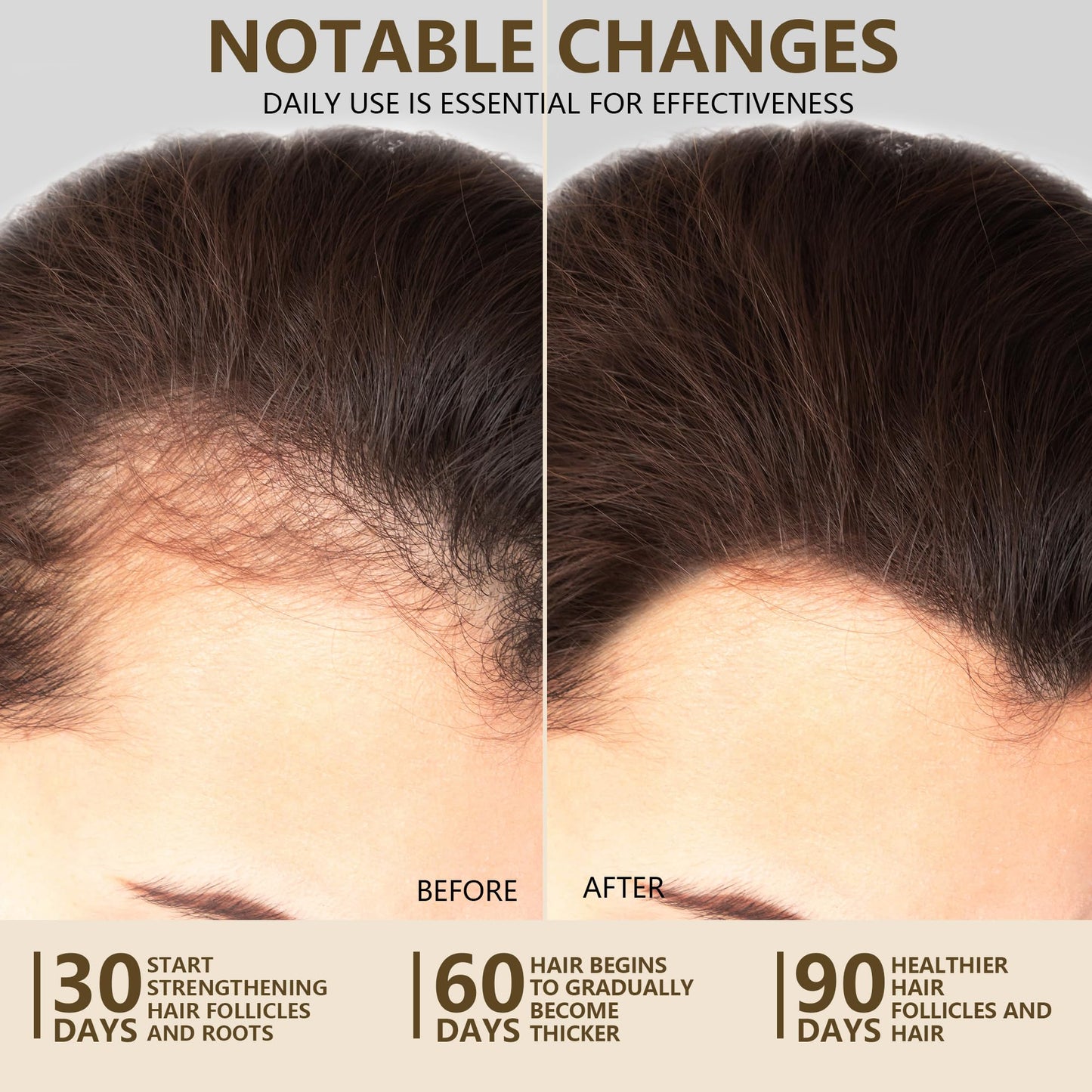 Ktintar 100% Natural Raw Batana Oil for Hair Growth, Unrefined & Organic Dr Sebi Hair Growth Oil From Honduras, Prevents Hair Loss, Eliminates Split