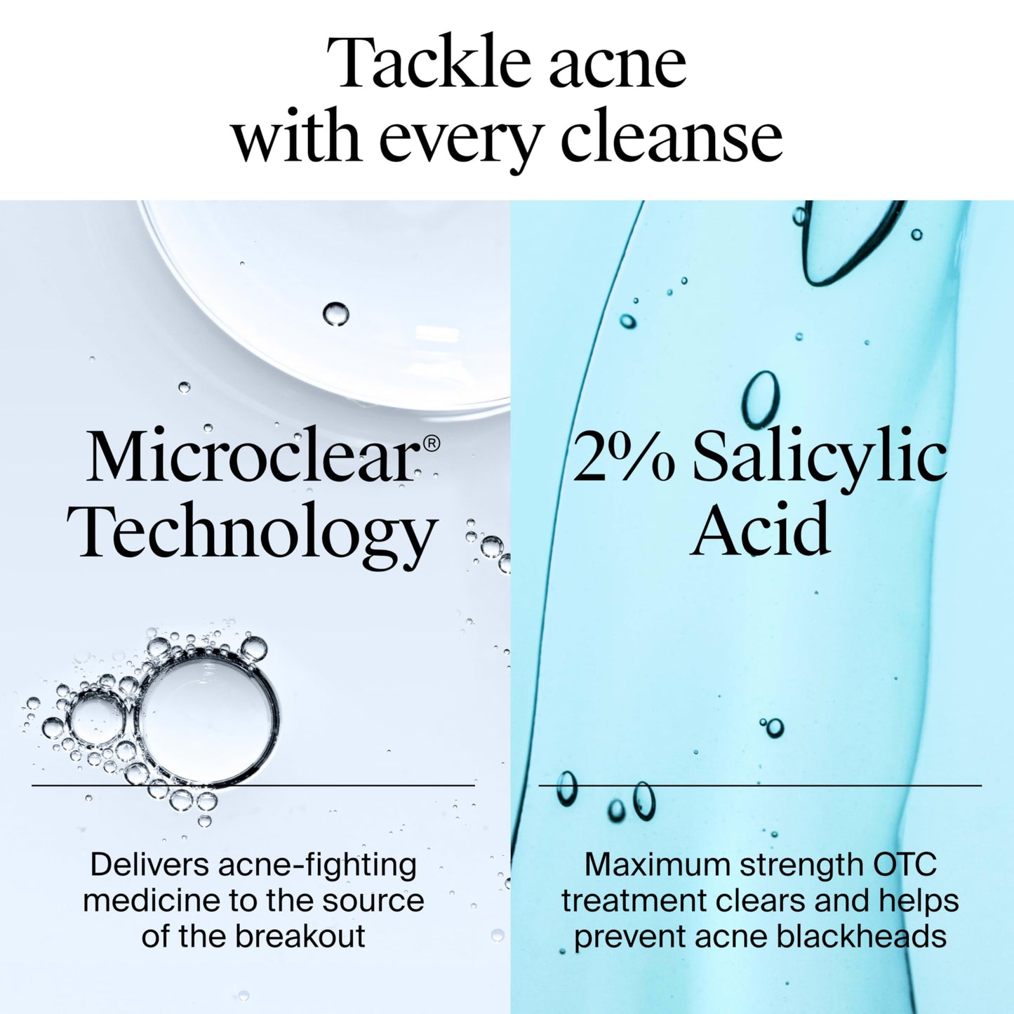 Neutrogena Oil-Free Acne Face Wash, Breakout Prone Skin Facial Cleanser with 2% Salicylic Acid Acne Treatment for Face, 6 fl. oz