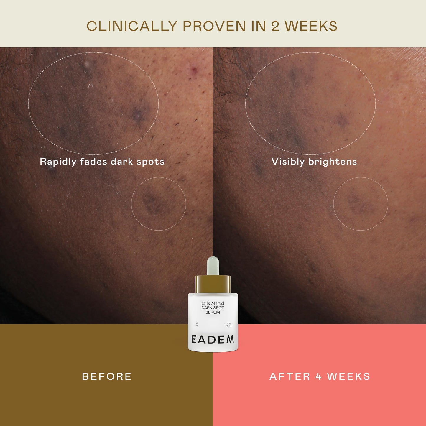 EADEM Milk Marvel Dark Spot Serum, Vitamin C Face Serum Infused with Niacinamide, Dark Spot Remover for Face and Body, Natural Dark Spot Corrector