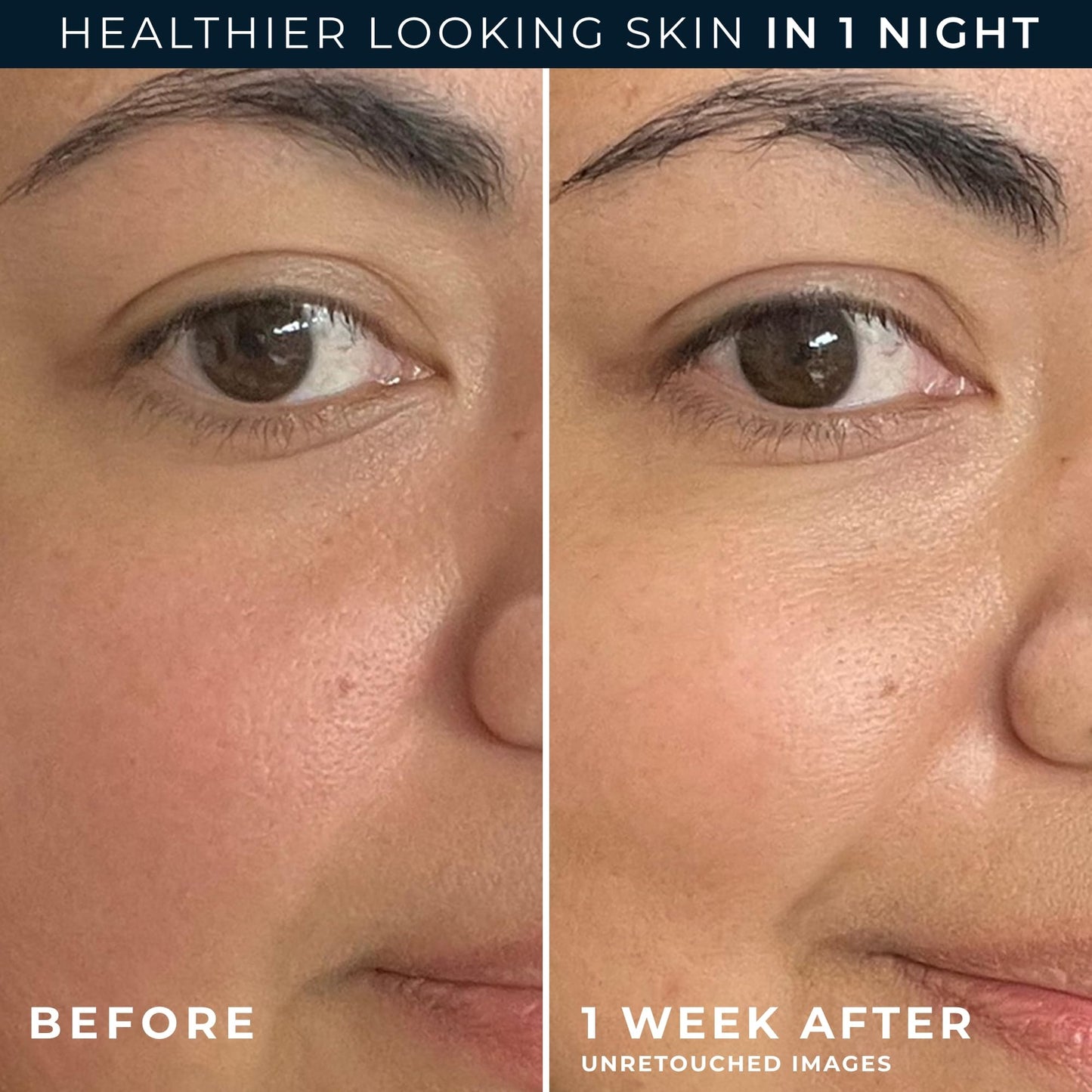 RoC Barrier Renew Night Moisturizer with Ceramides & Antioxidant Green Tea and Lipo Peptides to Renew Skin Barrier, (2.5 oz) with Retinol Eye Cream