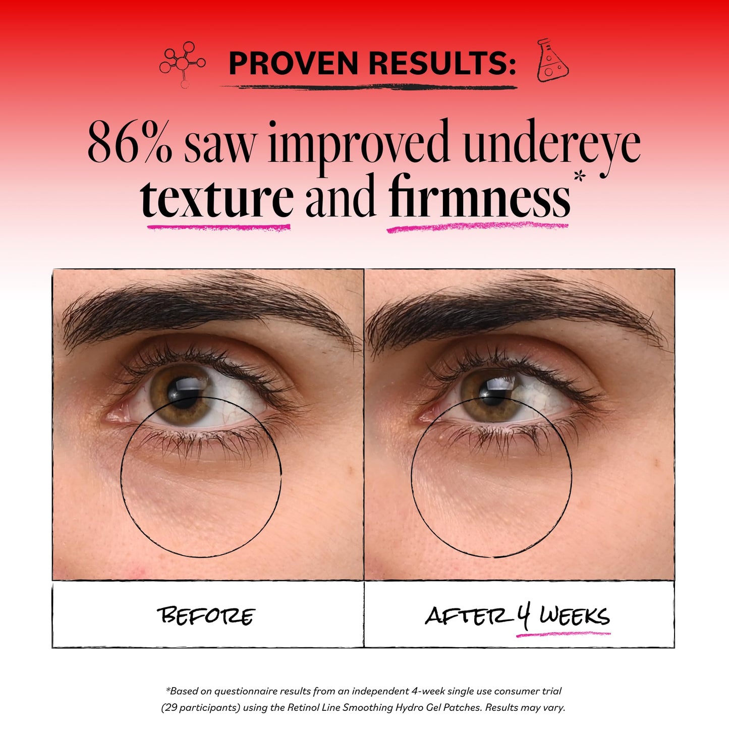 Derma E Retinol + Bakuchiol Under Eye Patches (30 Pairs) Non-Irritating, Line Smoothing Hydro Gel Eye Patches with Rose Water & Real Hibiscus Petals