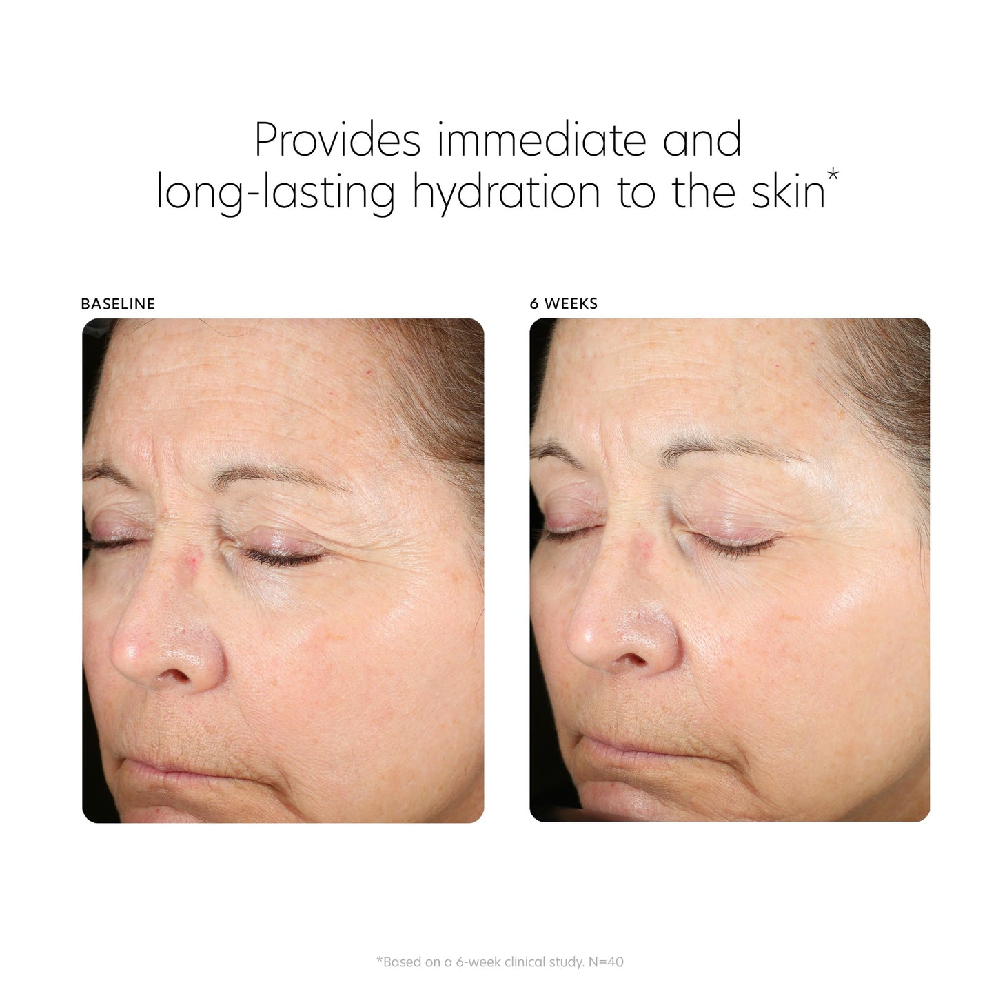 PCA SKIN Hyaluronic Acid Boosting Face Serum - Anti Aging Hydrating Facial Corrector with Niacinamide for Smoothing Wrinkles & Fine Lines (3 fl oz)