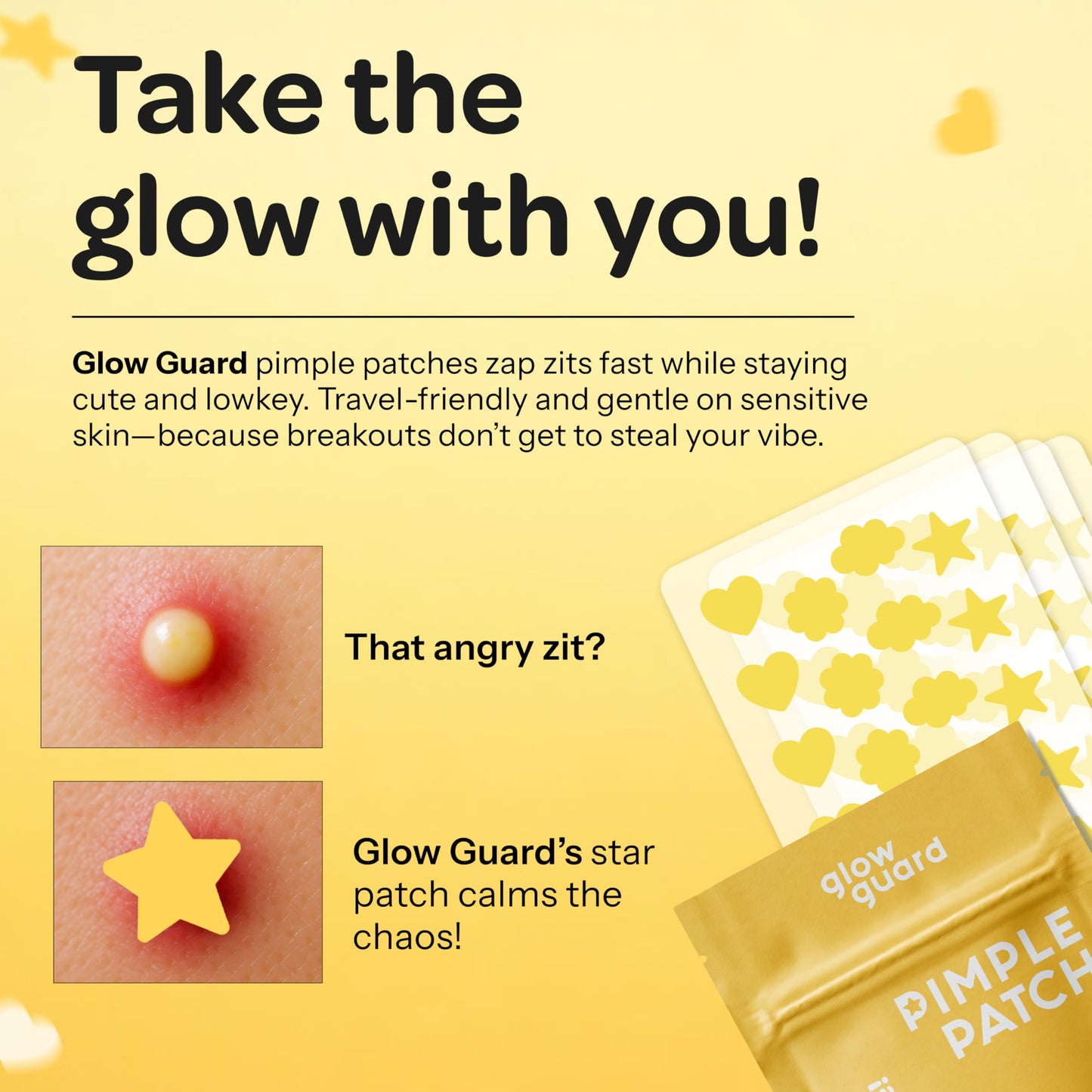 Glow Guard Pimple Patches with Hydrocolloid & Niacinamide - Dermatologist Tested, Anti Aging, Korean Skin Care - Yellow Shields Spots, Absorbs Oil