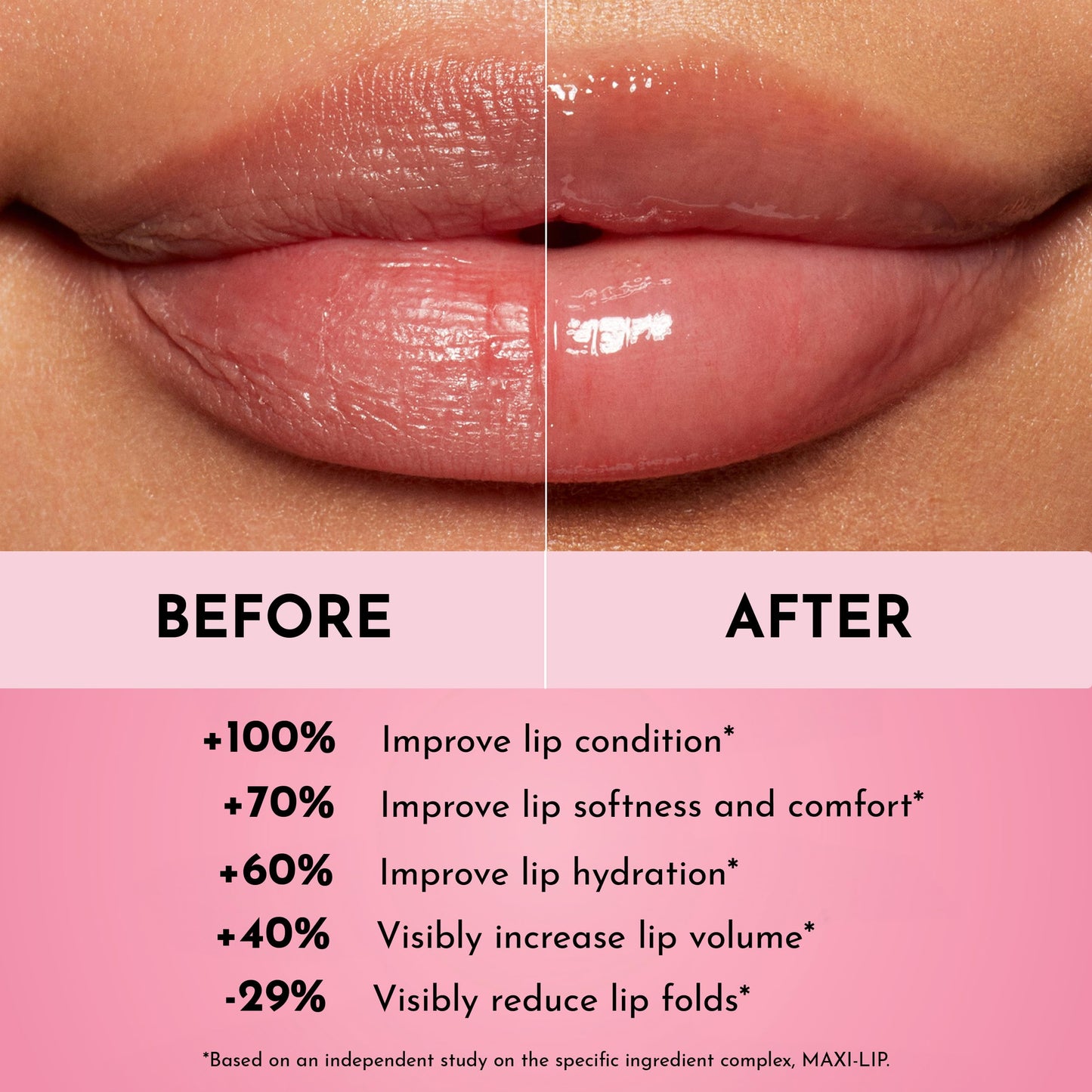 LAWLESS Forget the Filler Lip Mask - Sweet Dreams - Premium Overnight Lip Plumping Treatment with Natural Ingredients Designed to Plump, Hydrate, Beauty and Personal Care LAWLESS