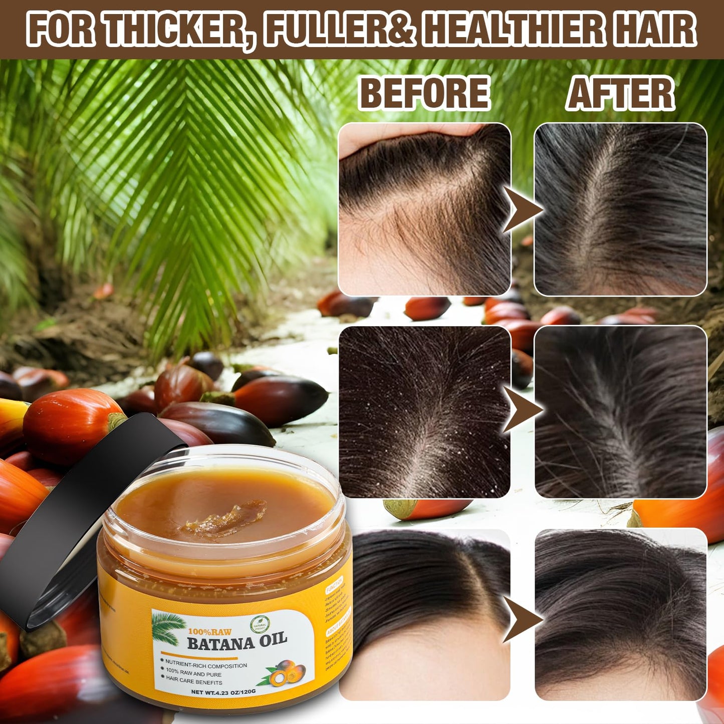 Andreyt Raw Batana Oil for Hair Growth, 100% Natural Pure Dr. Sebi Batana Oil from Honduras, Prevent Hair Loss, Promotes Hair Growth and Thickness