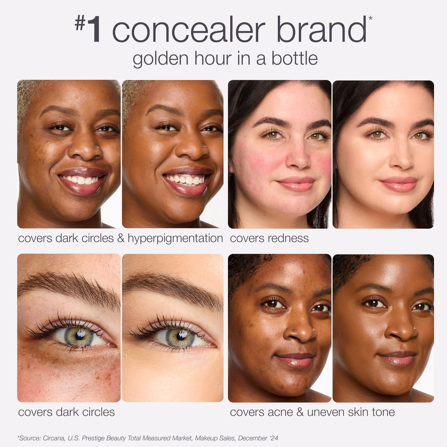 tarte shape tape radiant concealer - Medium-Coverage, Hydrating Finish Under Eye Concealer for Dark Circles, Redness & Discoloration, Vegan Beauty and Personal Care tarte