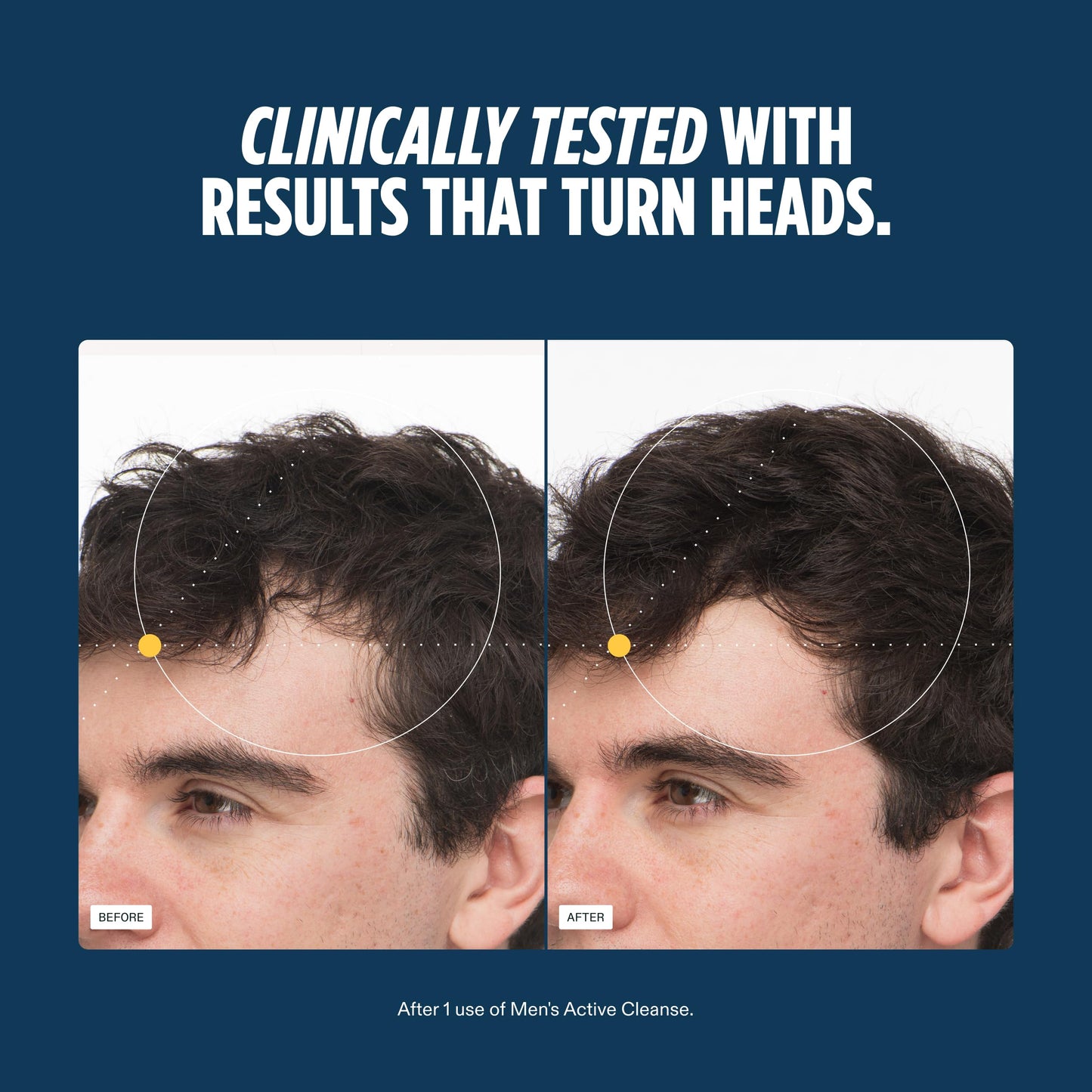 Nutrafol Men's Shampoo and Conditioner 2-in-1, Cleanses, Hydrates, Unclogs Pores, Improves Hair Volume & Strength, Physician-formulated for Thinning Beauty and Personal Care Nutrafol