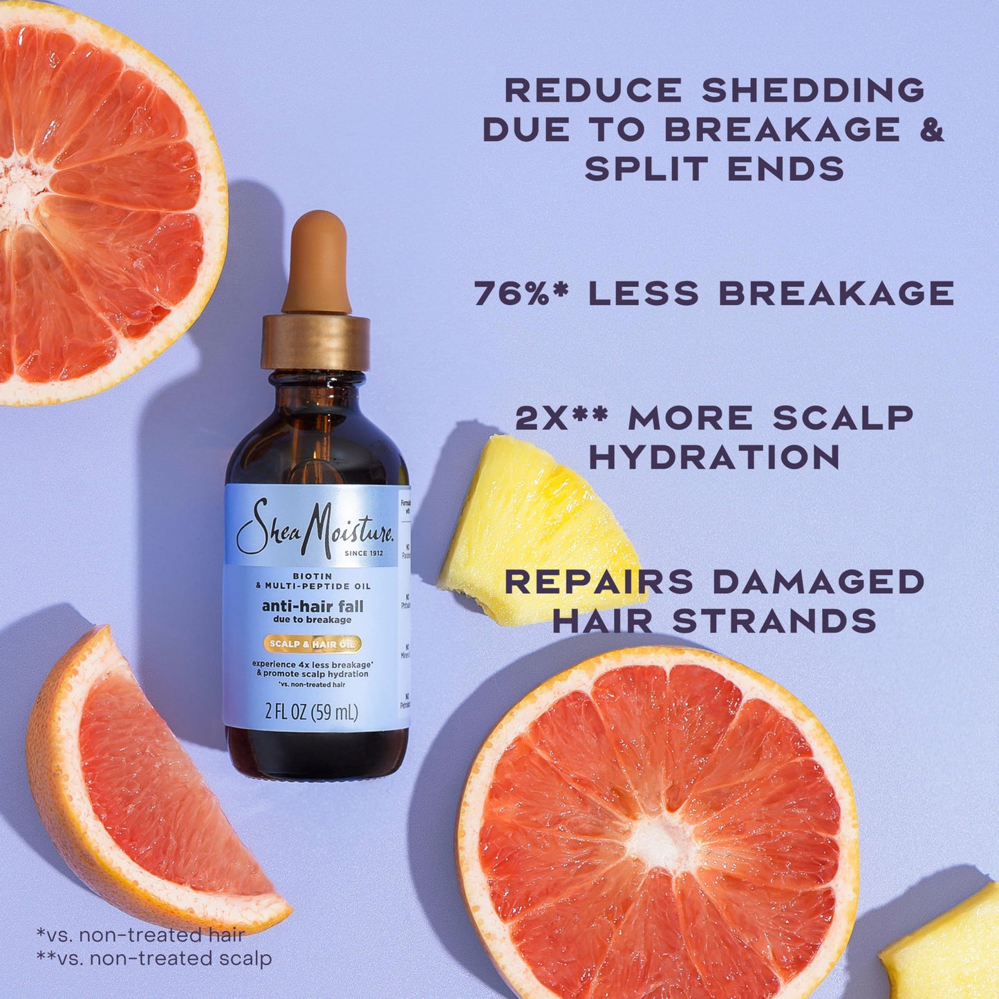 SheaMoisture Scalp & Hair Oil Anti-Hair Fall for Healthy Looking Hair and Moisturized Scalp, with Biotin & Multi-Peptide ScalpBoost Technology, 2 oz