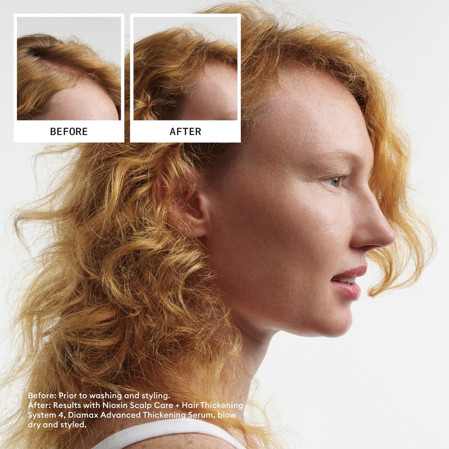 NIOXIN System 4 | Scalp Care | Thickening Conditioner | Colored Dry Hair Beauty and Personal Care NIOXIN