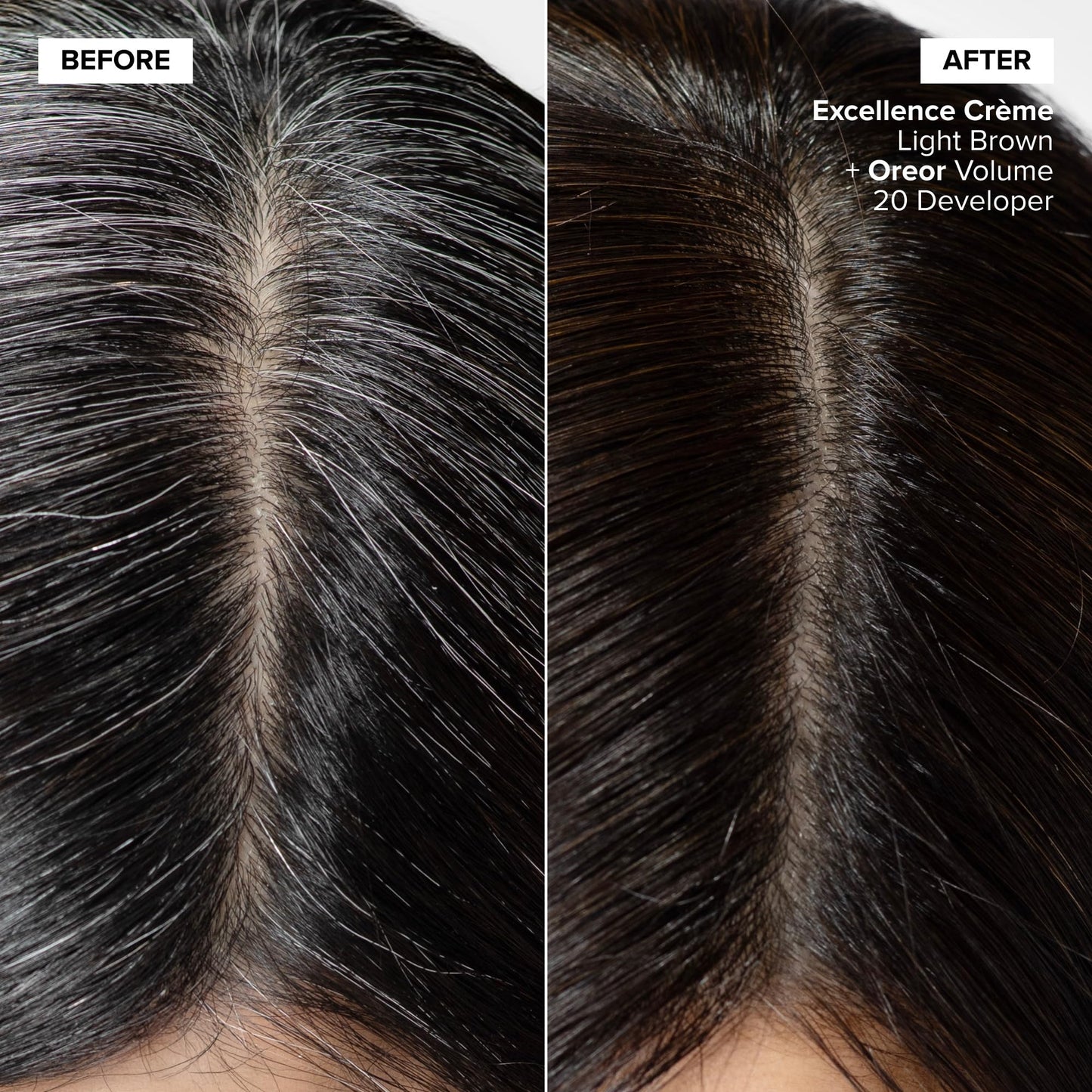 L'Oréal Technique Excellence Crème Permanent Hair Color - Long-Lasting Hair Dye, Rich Formula With No-Drip Application, Superb Gray Coverage, Dark Beauty and Personal Care L'OREAL TECHNIQUE
