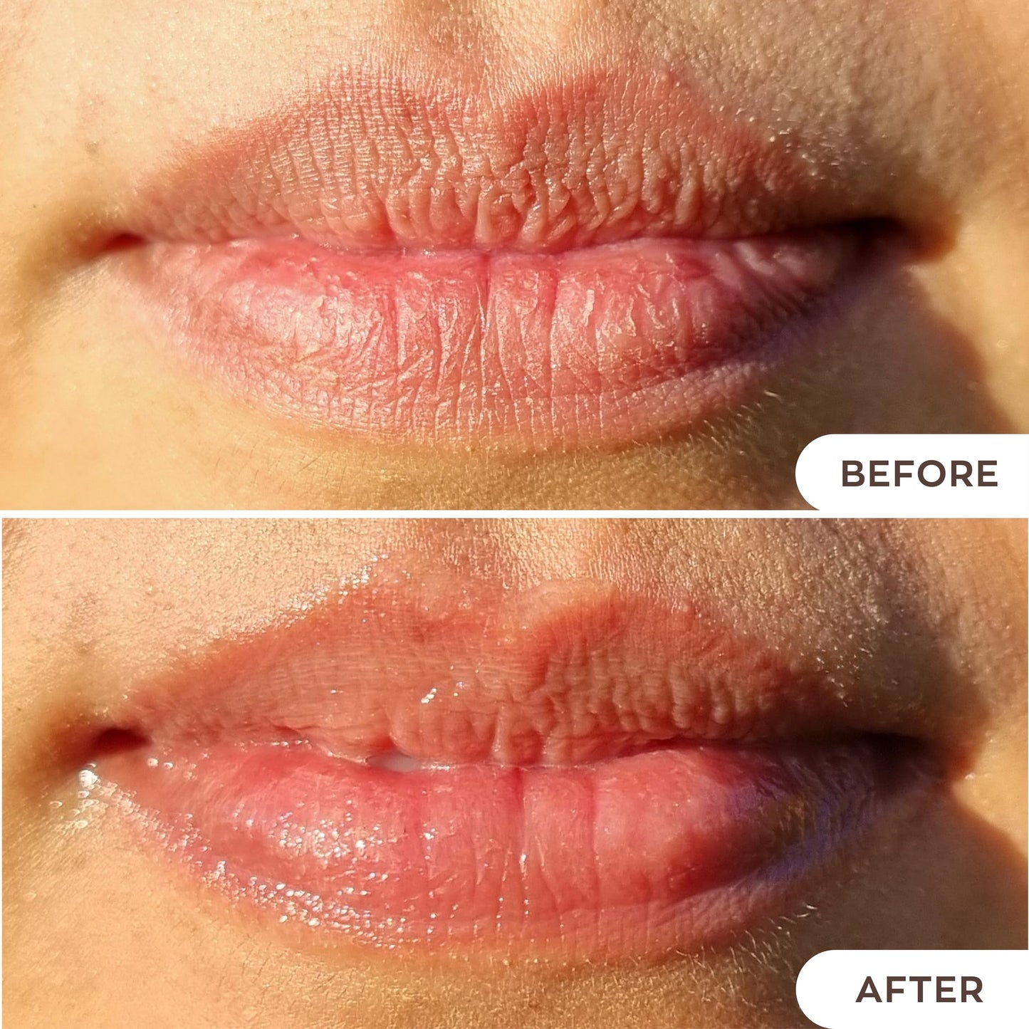 Hanalei Lip Treatment for Dry, Chapped Lips - Intensive Overnight Moisturizer with Kukui Oil, Shea Butter & Grapeseed Oil - Hydrating Balm for Healing