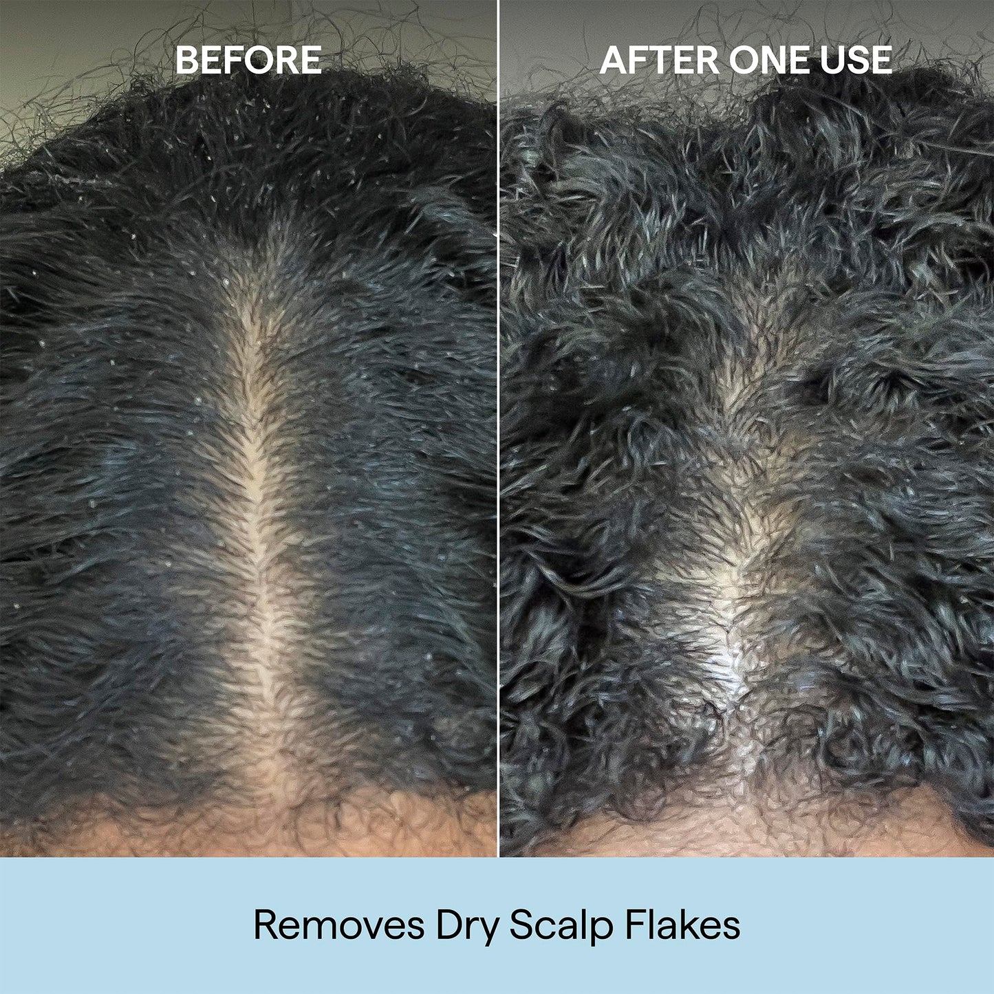 Briogeo Scalp Revival Charcoal + Coconut Oil Micro-Exfoliating Shampoo | Sulfate-Free Scalp Scrub for Dry, Itchy, or Oily Scalp | Detoxifying Beauty and Personal Care Briogeo