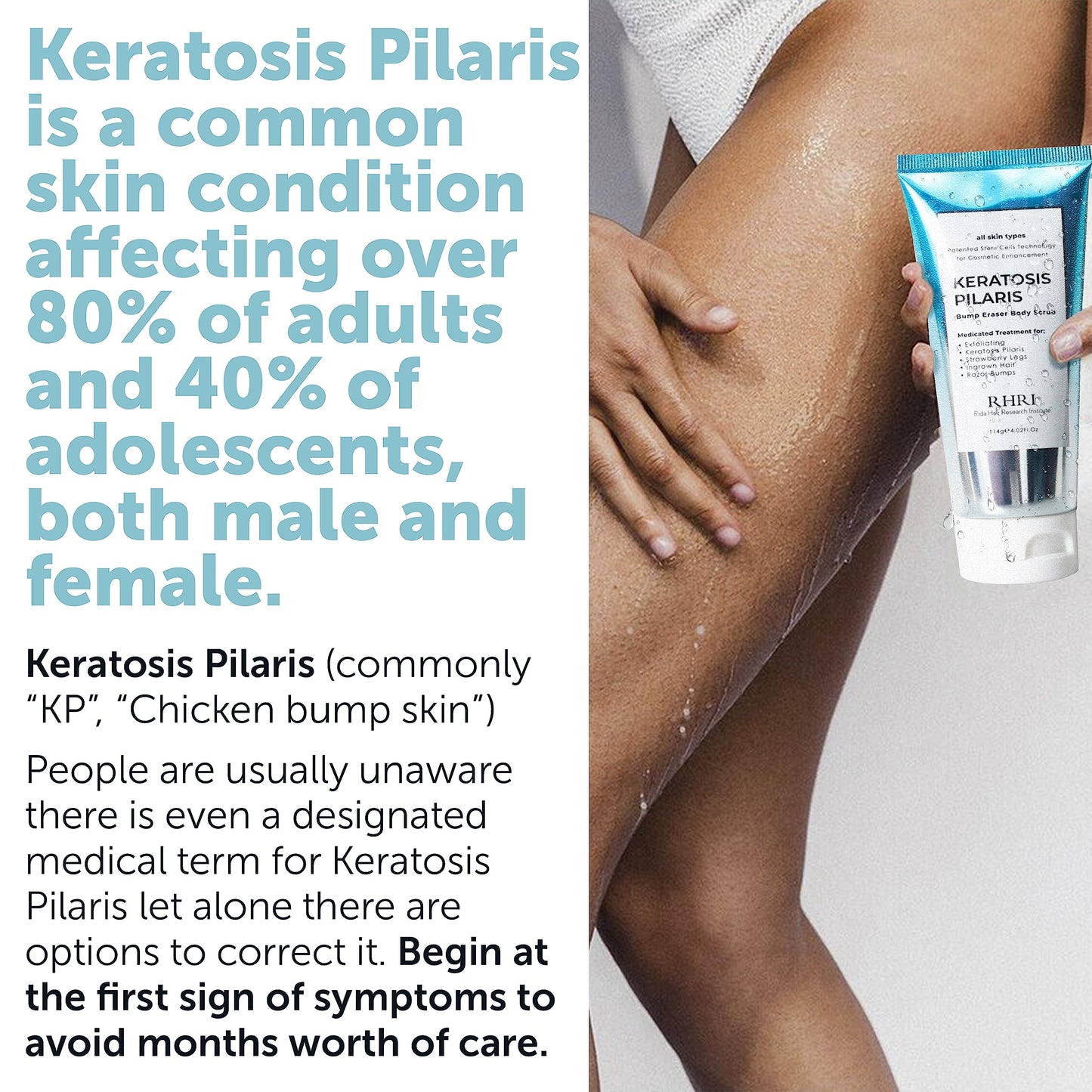 KP Bump Eraser Body Scrub | Exfoliating Body Scrun | Ingrown Hair Treatment | Clears Strawberry Legs | Soothes Redness, Dryness & Flaky Skin