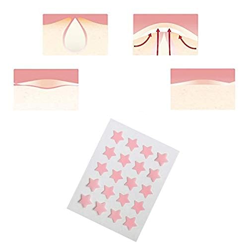 AGRCARE Acne Pimple Patch, Hydrocolloid Absorbing Patch Clear Acne Stickers (2 Sheets/40Patchs)