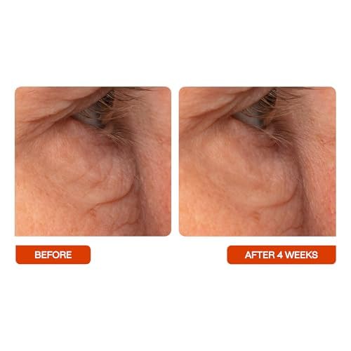 BeautyStat Universal C Skin Refiner - Vitamin C Serum for Face, 20% Pure L-Ascorbic Acid - Created by a 20+ Year Skincare Veteran Cosmetic Chemist