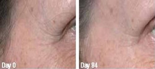 Gaba Freeze 24/7 Serum for Skin tightening, firming and sagging prevention. Also has 17% GABA (Gamma Amino Butryic Acid) causes Crease Release